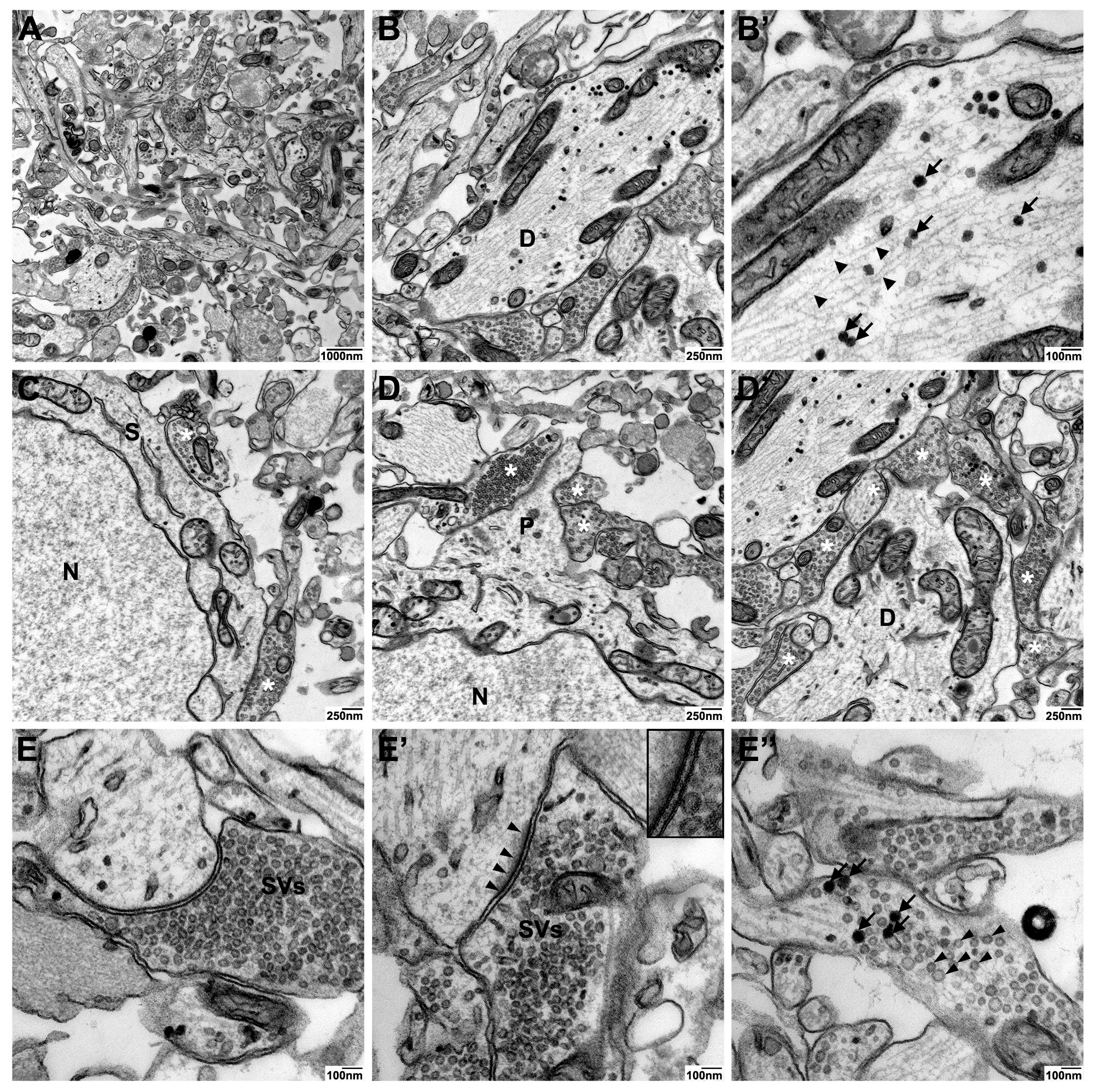 A high magnification image of synapse obtained by electron microscopy