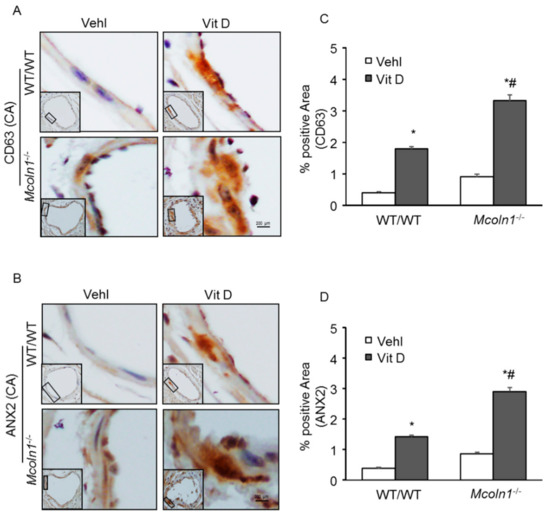 IJMS | Special Issue : Biogenesis and Functional Roles of Lysosomes