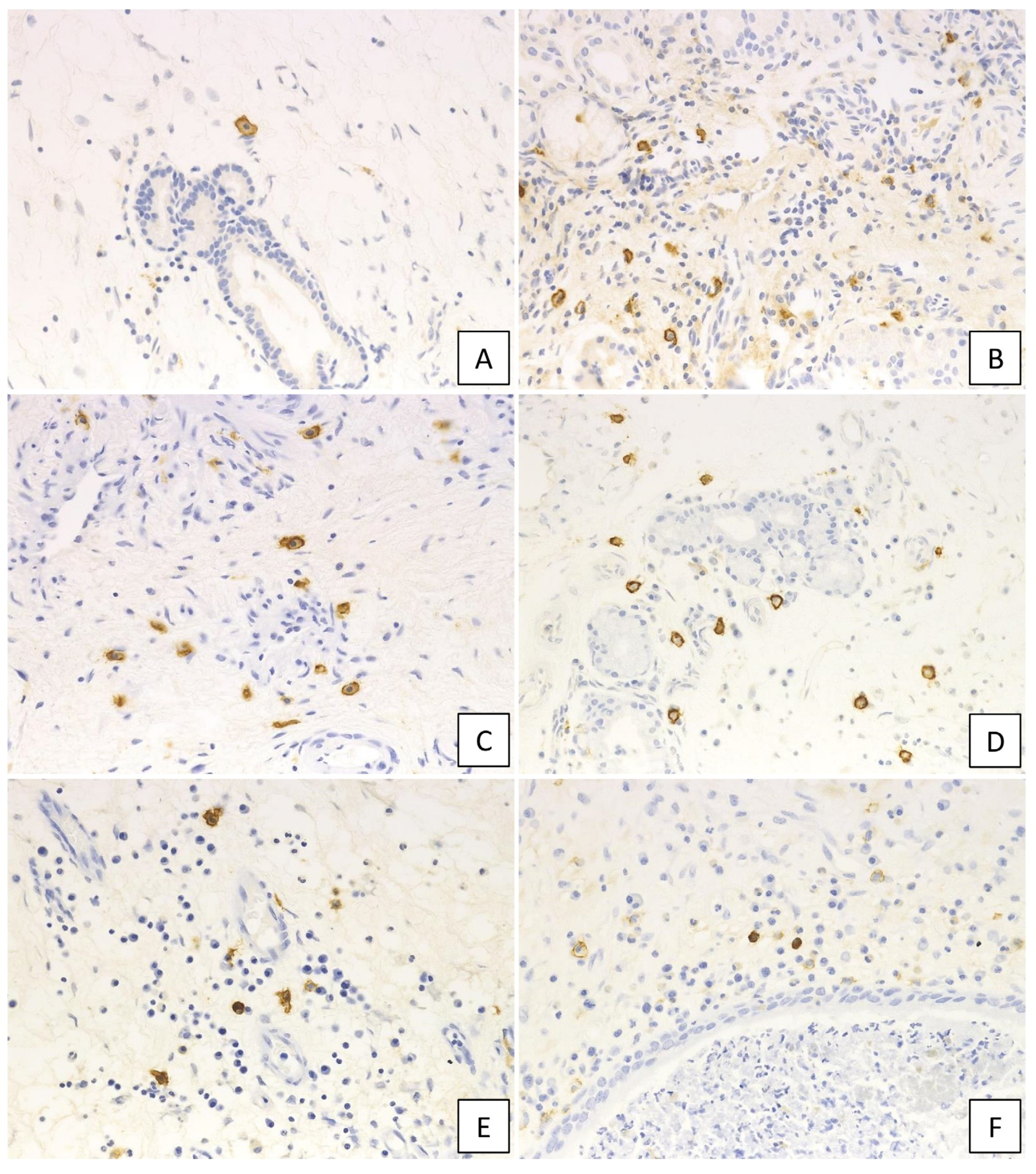 Ijms 21 01843 g004 Ijms 21 01843 g004