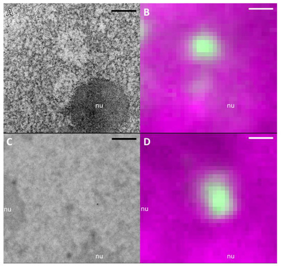 Correlative Light and Electron Microscopy (CLEM) Analysis of Nuclear ...