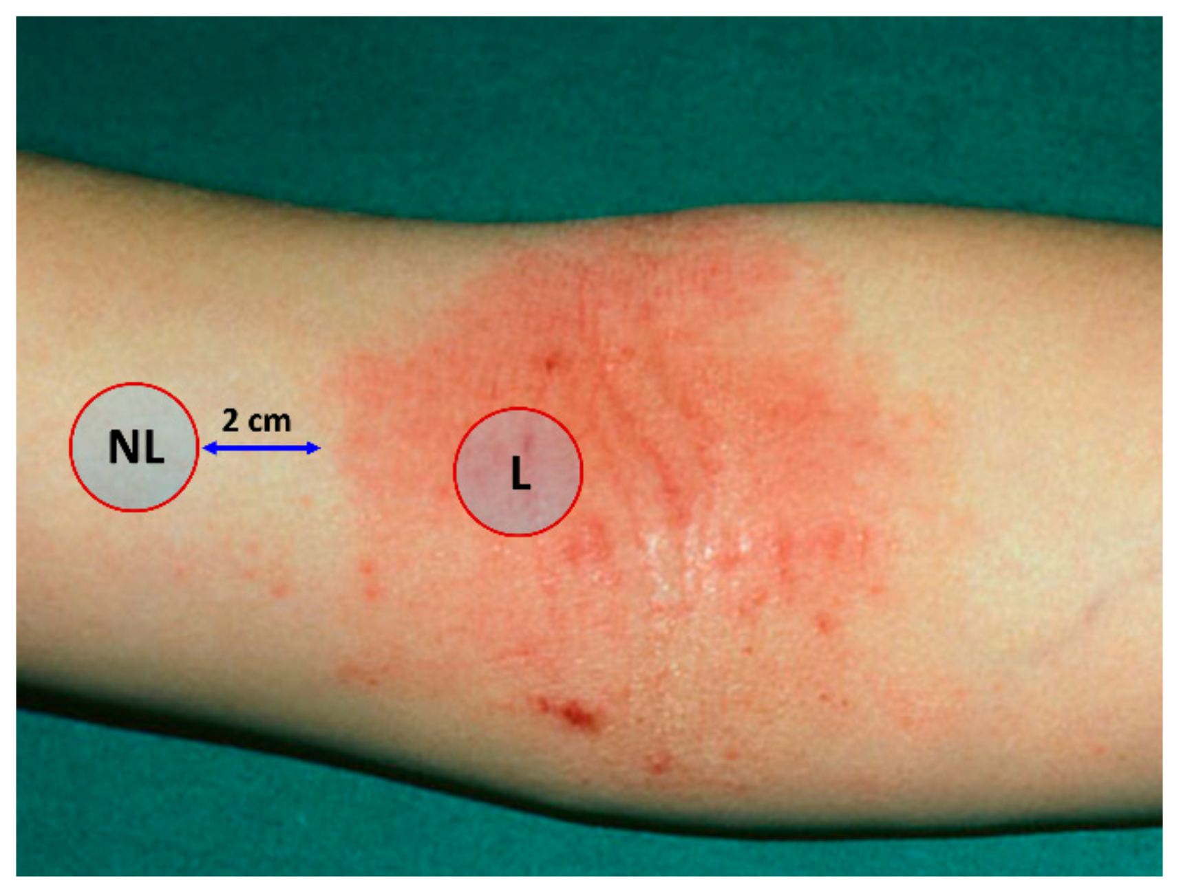 Ijms 21 01958 g008 Ijms 21 01958 g008