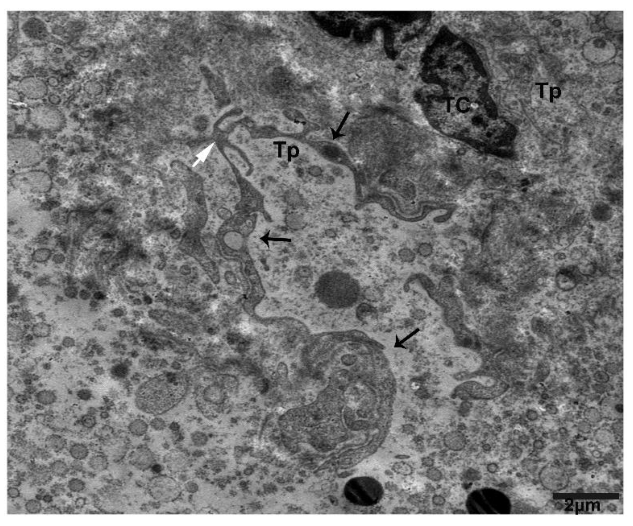 Ijms 21 02057 g008 Ijms 21 02057 g008