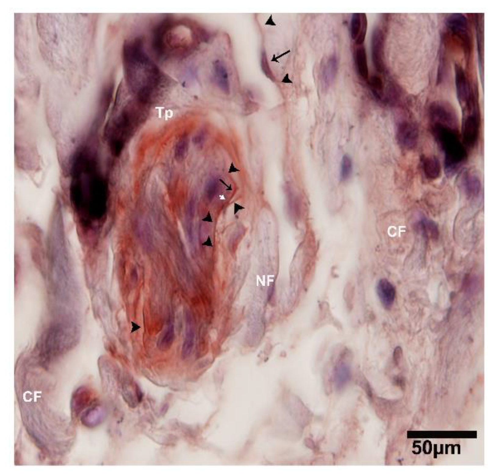 Ijms 21 02057 g010 Ijms 21 02057 g010