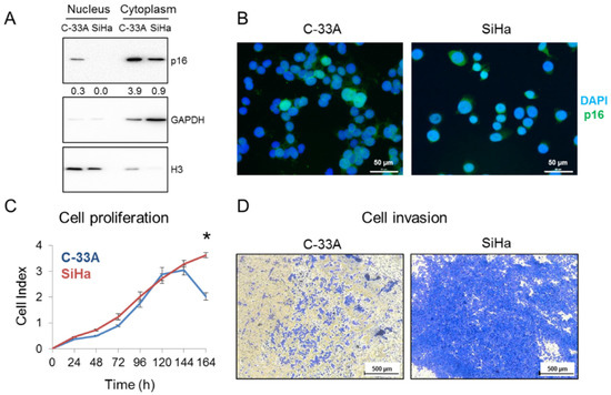 Absence of Nuclear p16 Is a Diagnostic and Independent Prognostic