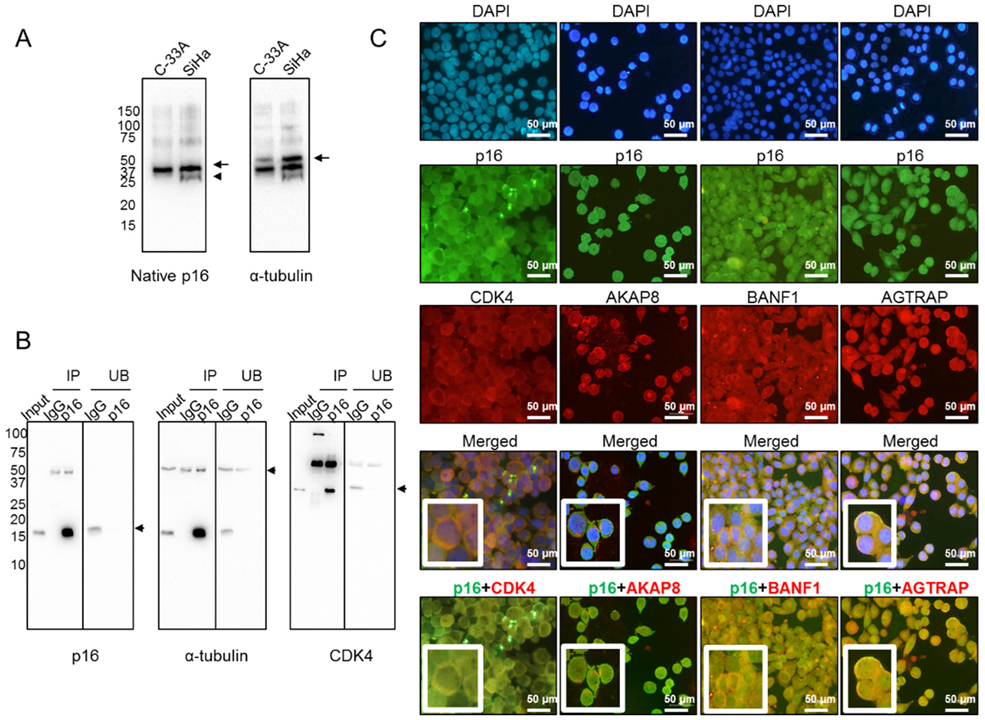 Ijms 21 02125 g004 Ijms 21 02125 g004