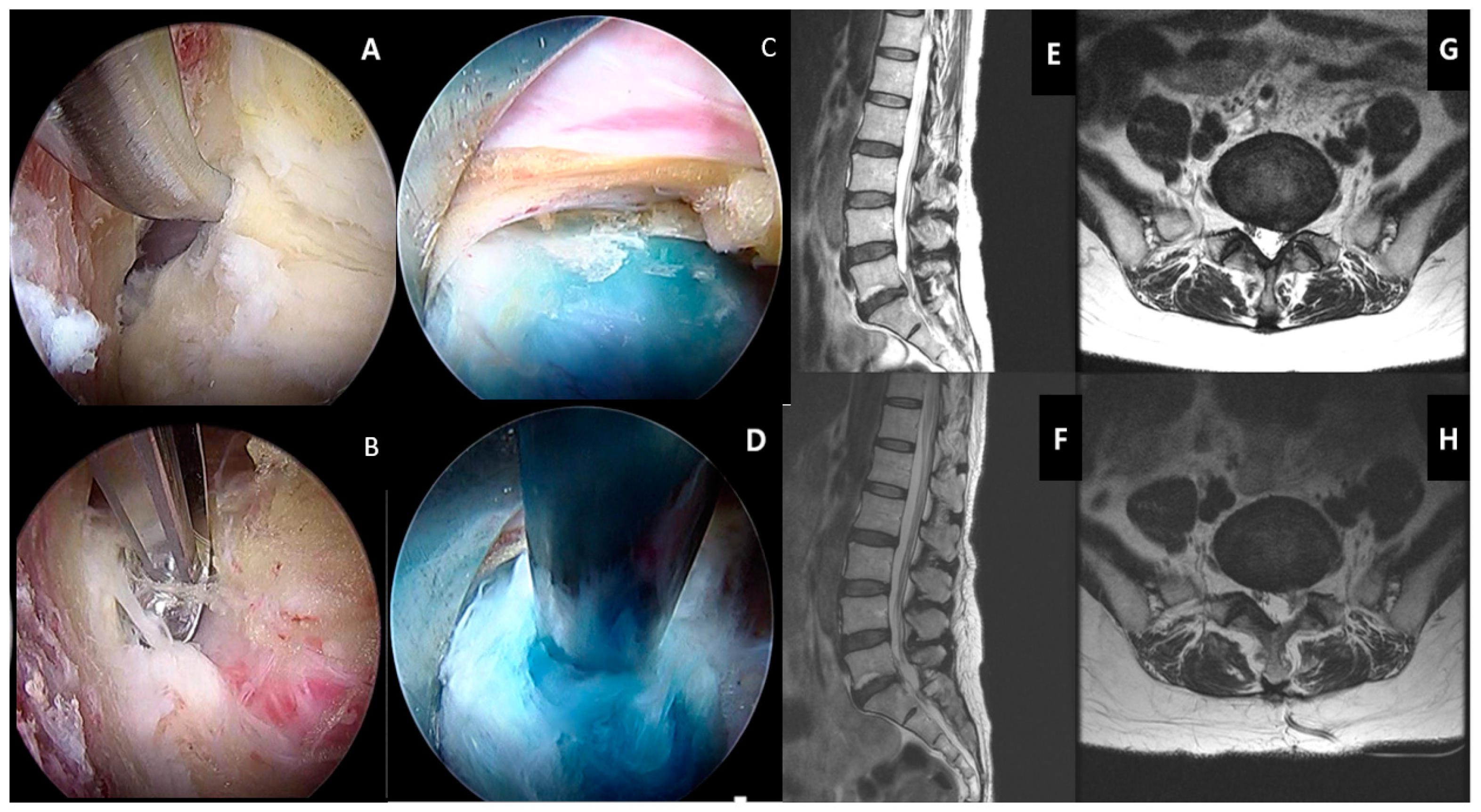 Intervertebral Disc Diseases PART 2: A Review of the Current