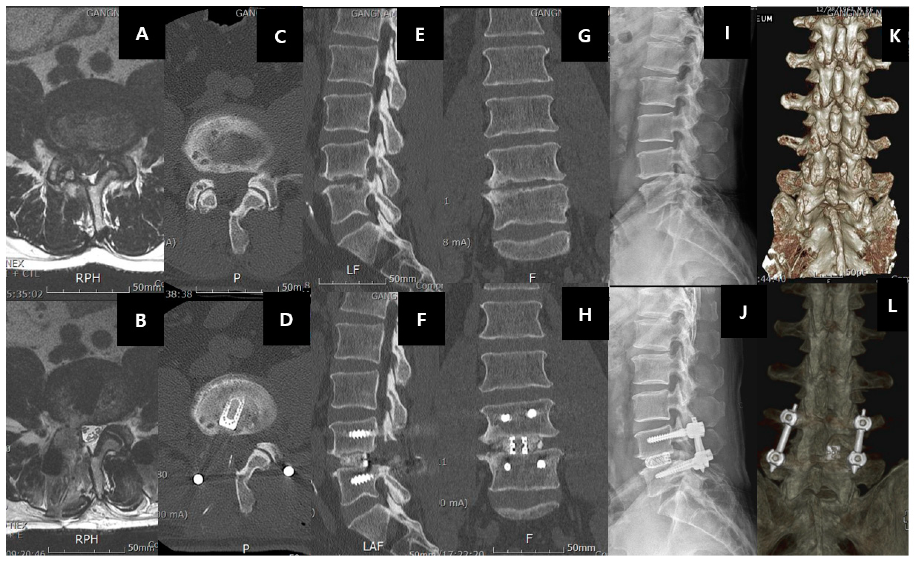 Intervertebral Disc Diseases PART 2: A Review of the Current