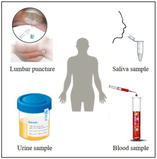 Cancer Diagnosis through SERS and Other Related Techniques