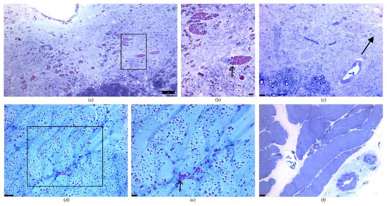 IJMS | Special Issue : Biogenesis and Functional Roles of Lysosomes