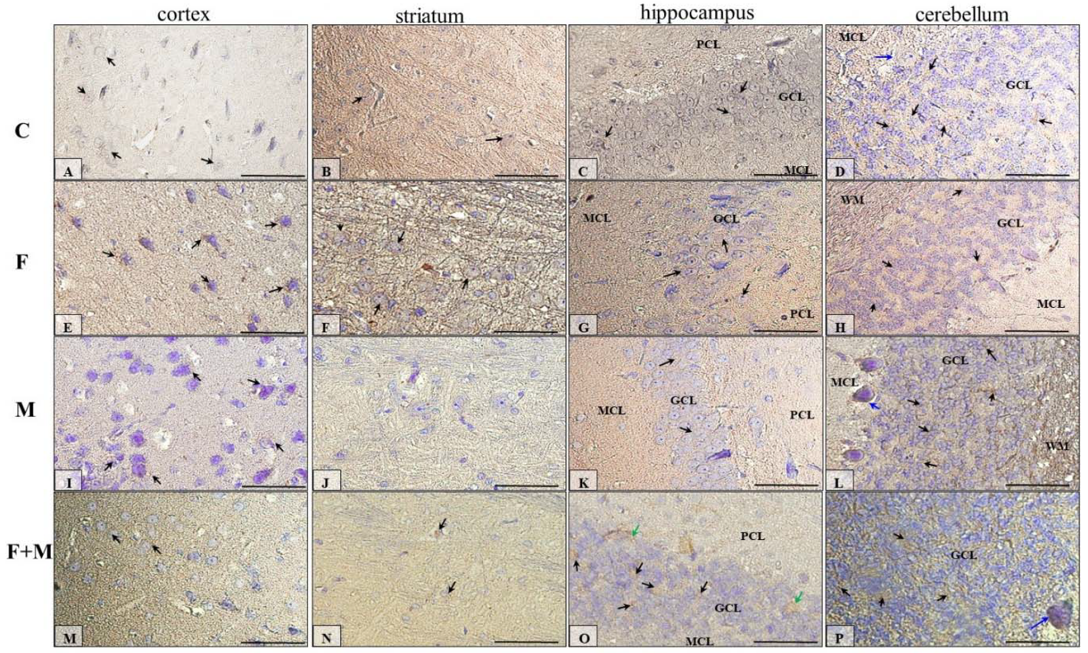 Ijms Free Full Text Fluoride Affects Dopamine Metabolism And Causes Changes In The Expression Of Dopamine Receptors D1r And D2r In Chosen Brain Structures Of Morphine Dependent Rats Html