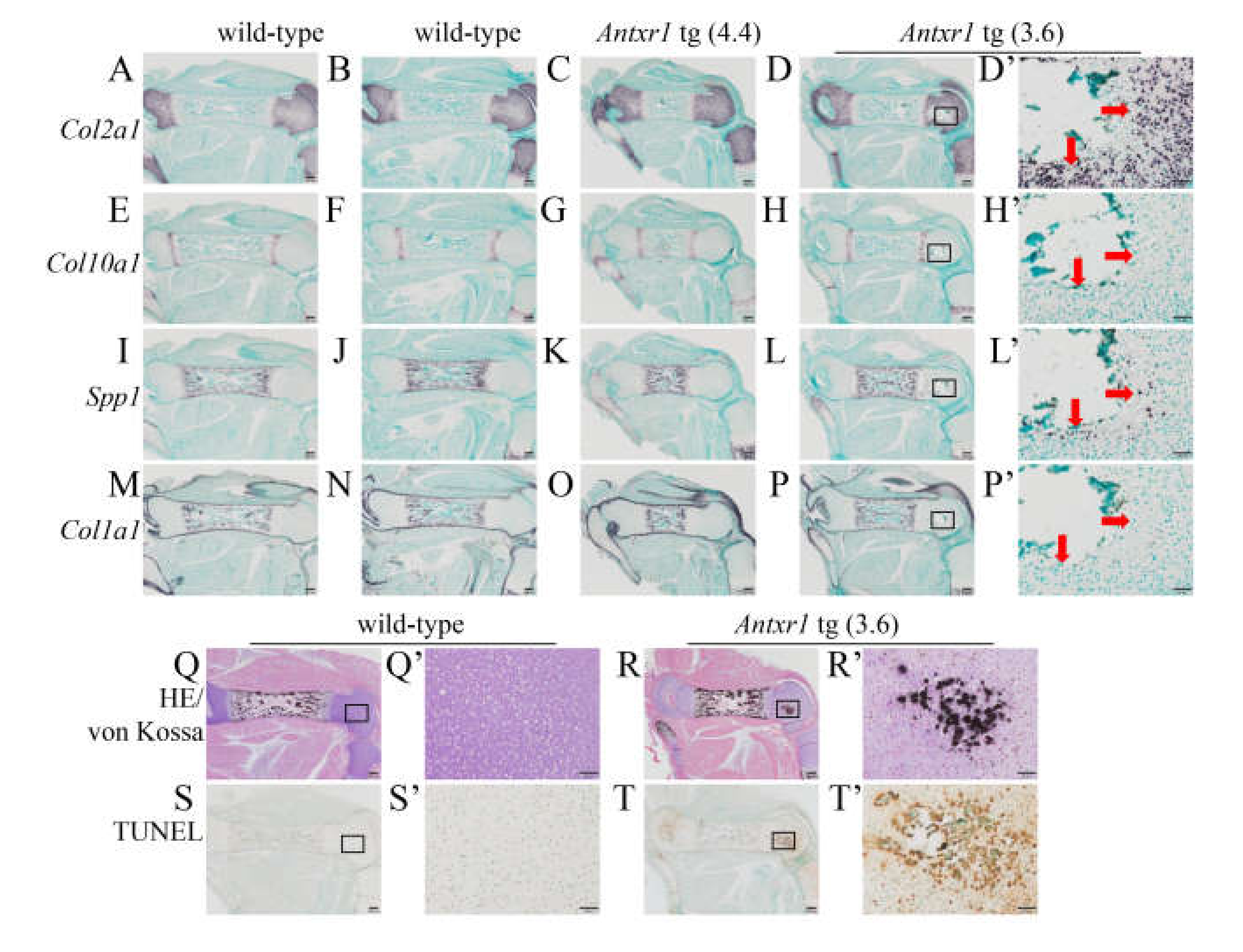 Ijms Free Full Text Antxr1 Which Is A Target Of Runx2 Regulates Chondrocyte Proliferation And Apoptosis Html