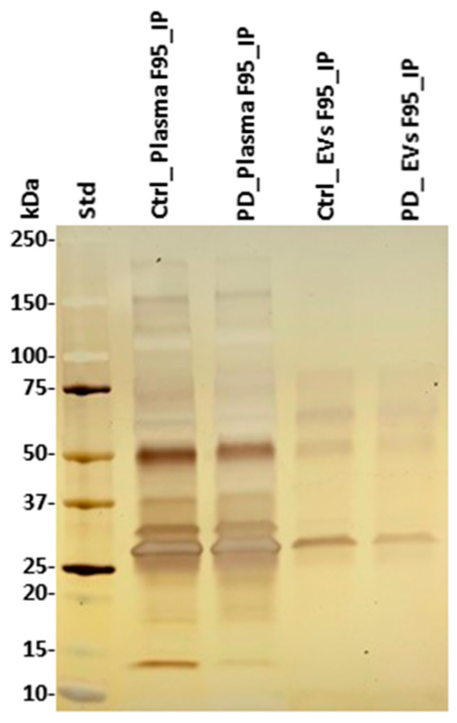 Ijms 21 02743 g004 Ijms 21 02743 g004