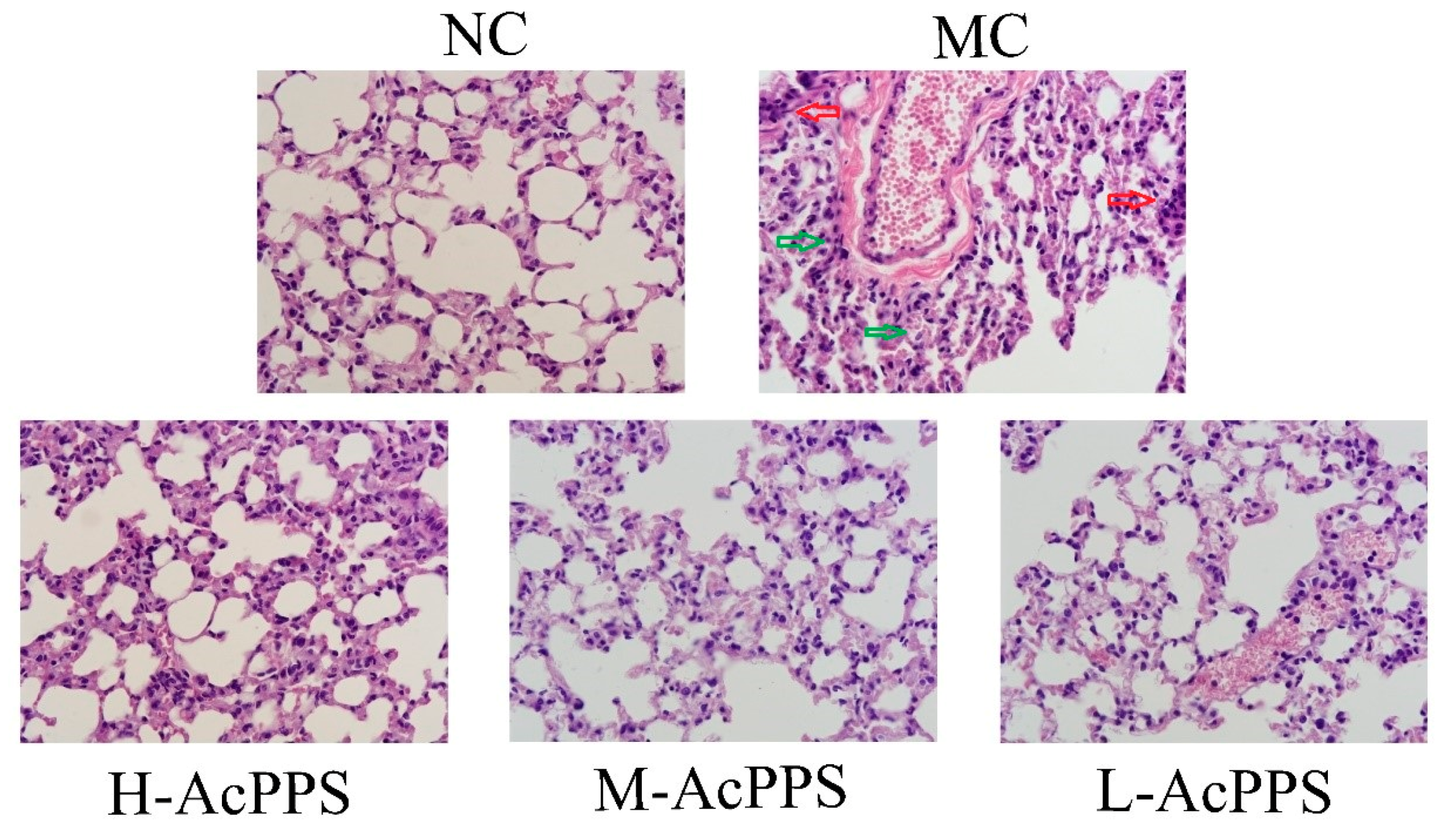 Ijms 21 02810 g004 Ijms 21 02810 g004