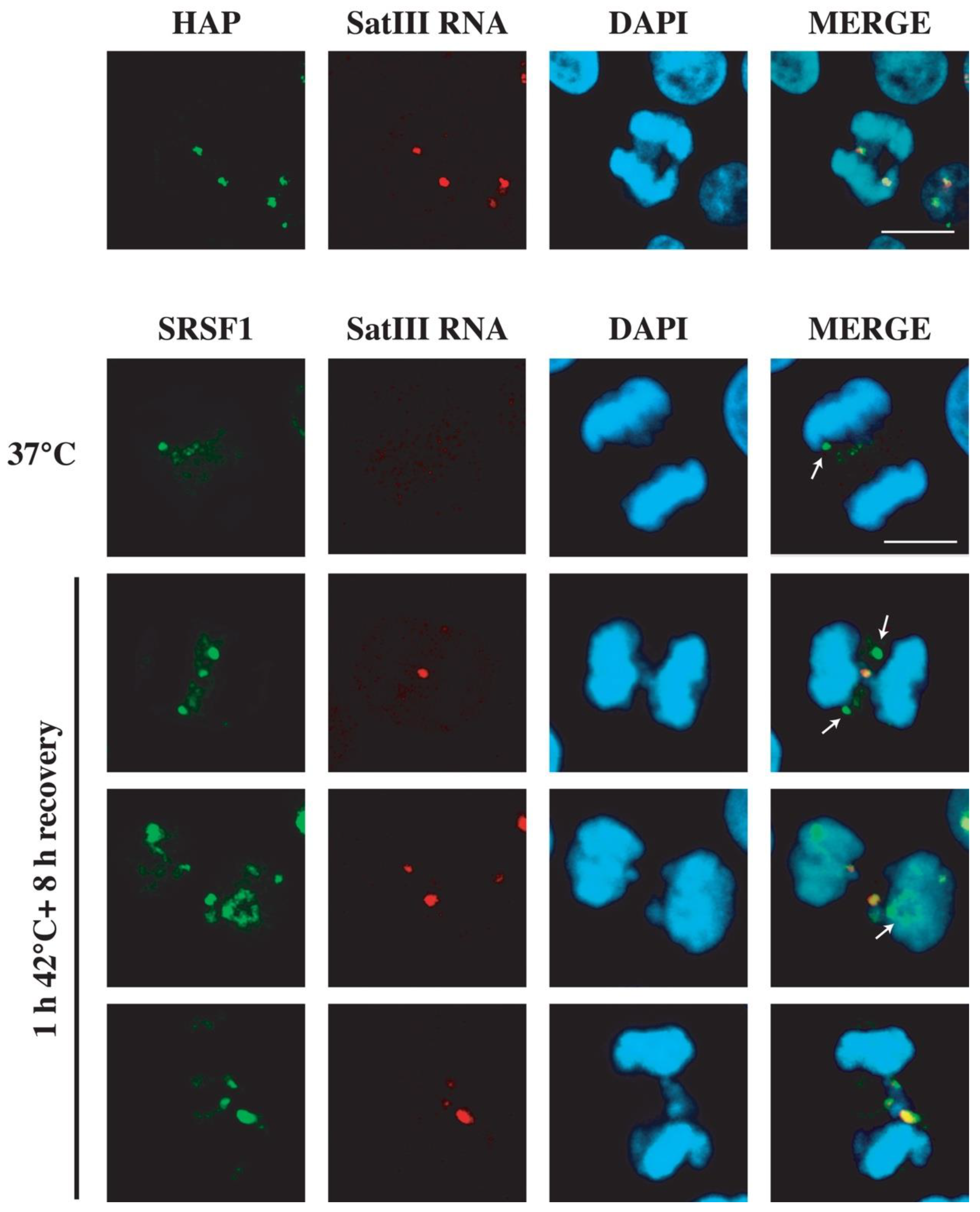 Heat Shock Affects Mitotic Segregation of Human ... Biology Diagrams