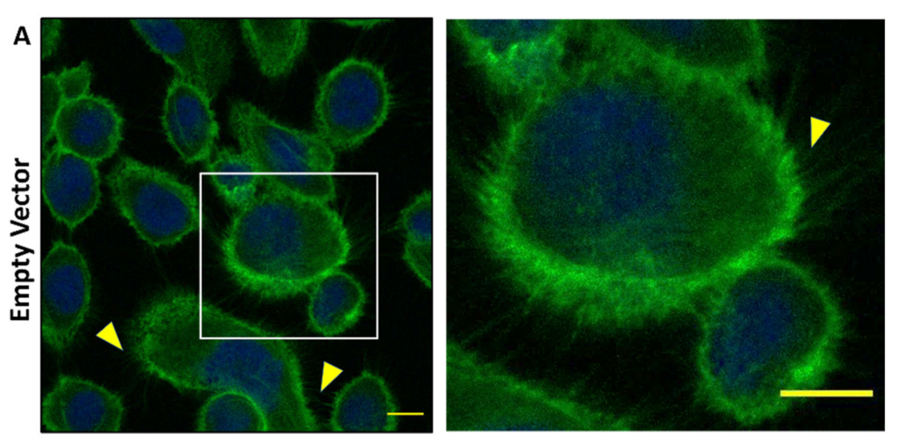 Ijms 21 03047 g004a Ijms 21 03047 g004a