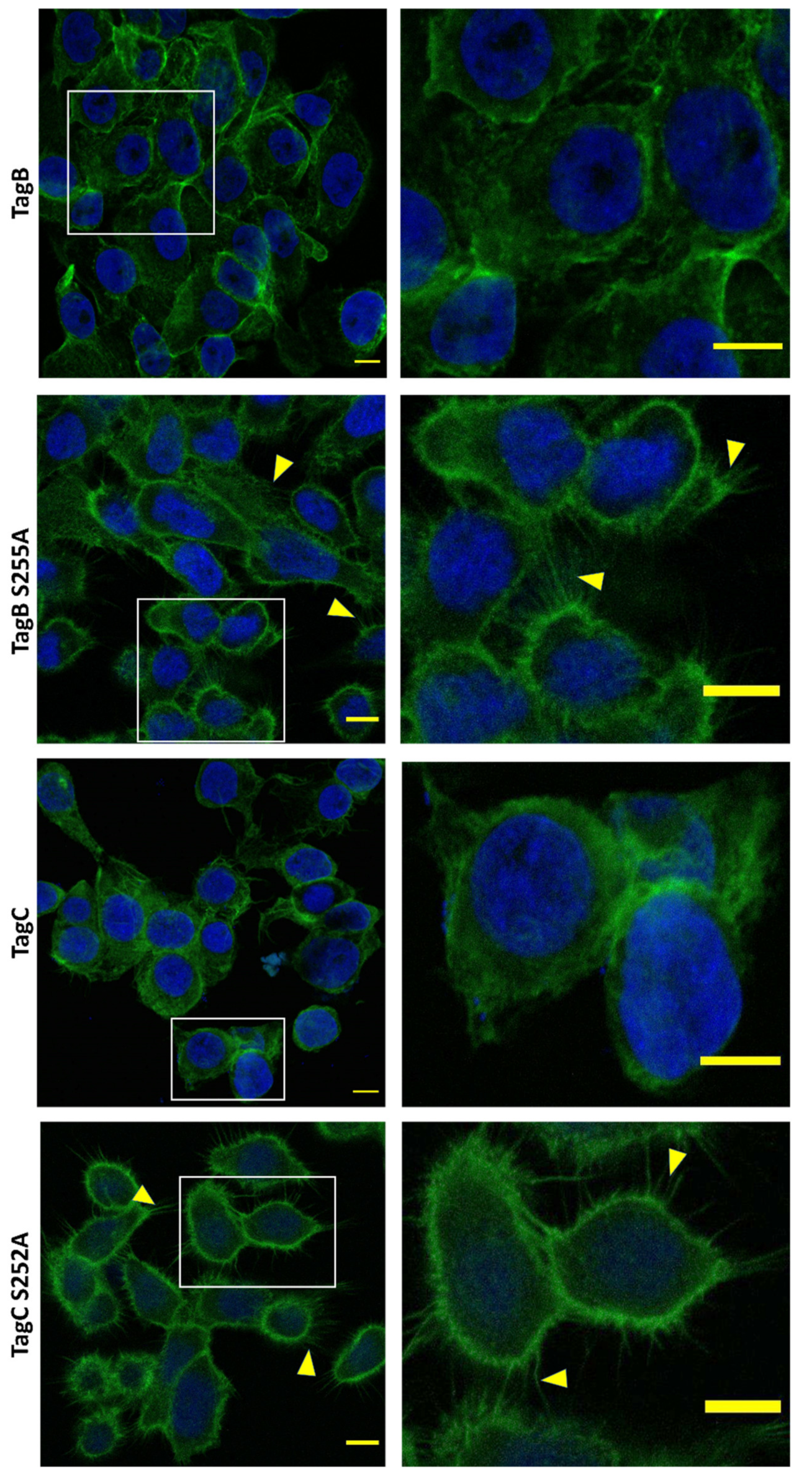 Ijms 21 03047 g004b Ijms 21 03047 g004b