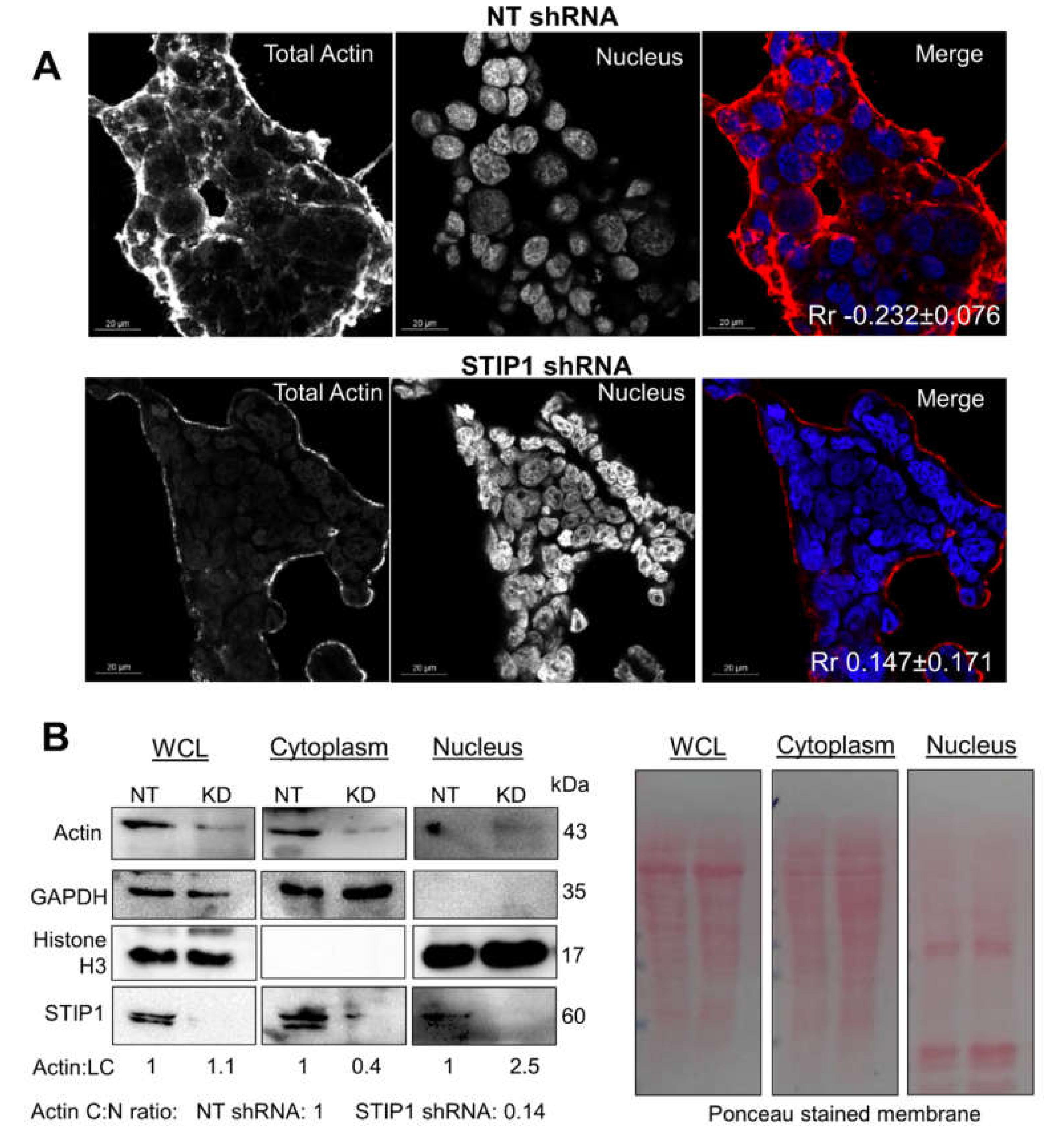 Ijms 21 03152 g005 Ijms 21 03152 g005