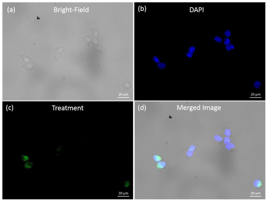 Novel Phenothiazine-Bridged Porphyrin-(Hetero)aryl dyads: Synthesis, Optical Properties, In Vitro Cytotoxicity and Staining of Human Ovarian Tumor Cell Lines Novel Phenothiazine-Bridged Porphyrin-(Hetero)aryl dyads: Synthesis, Optical Properties, In Vitro Cytotoxicity and Staining of Human Ovarian Tumor Cell Lines