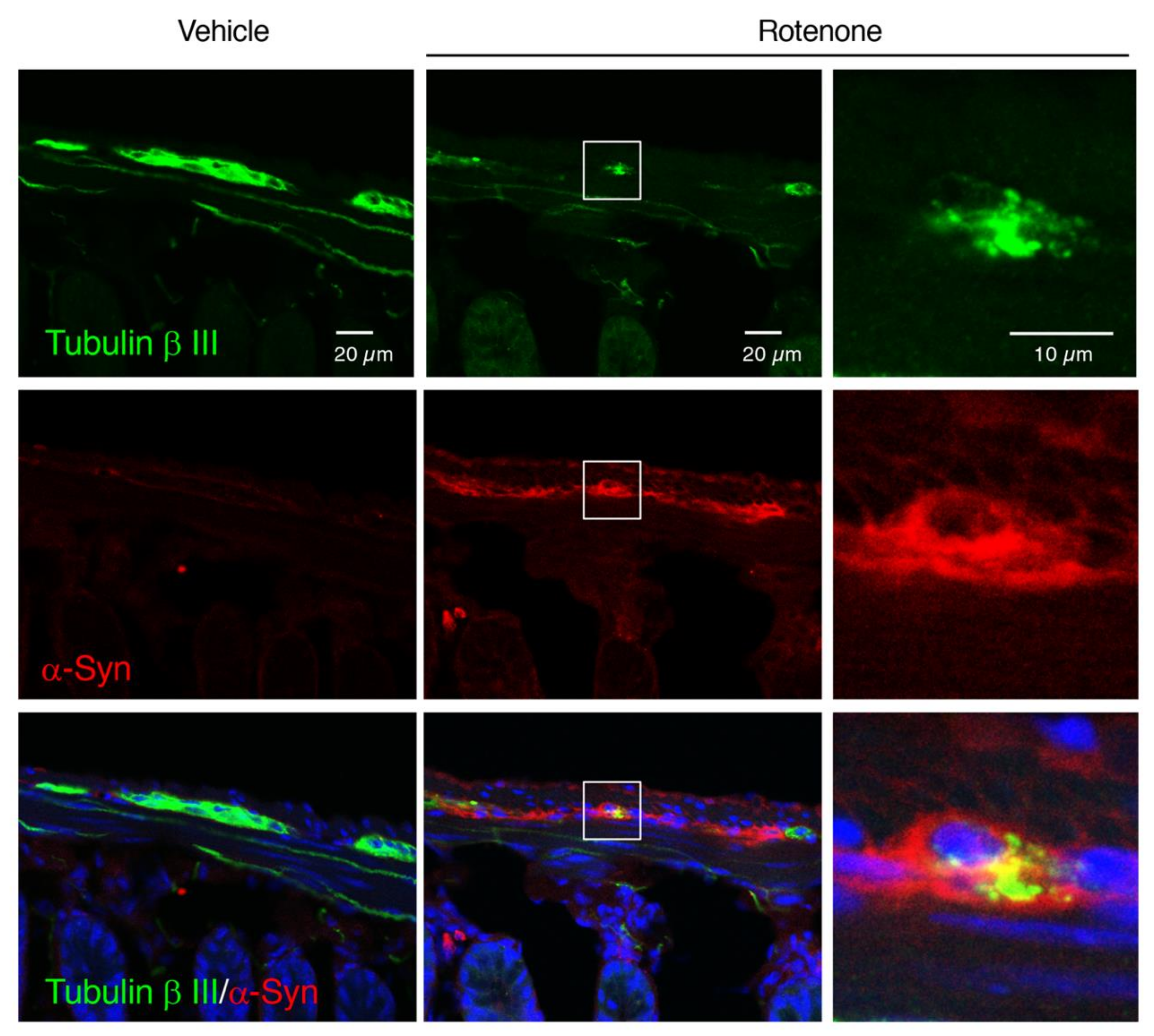 Ijms 21 03254 g009 Ijms 21 03254 g009