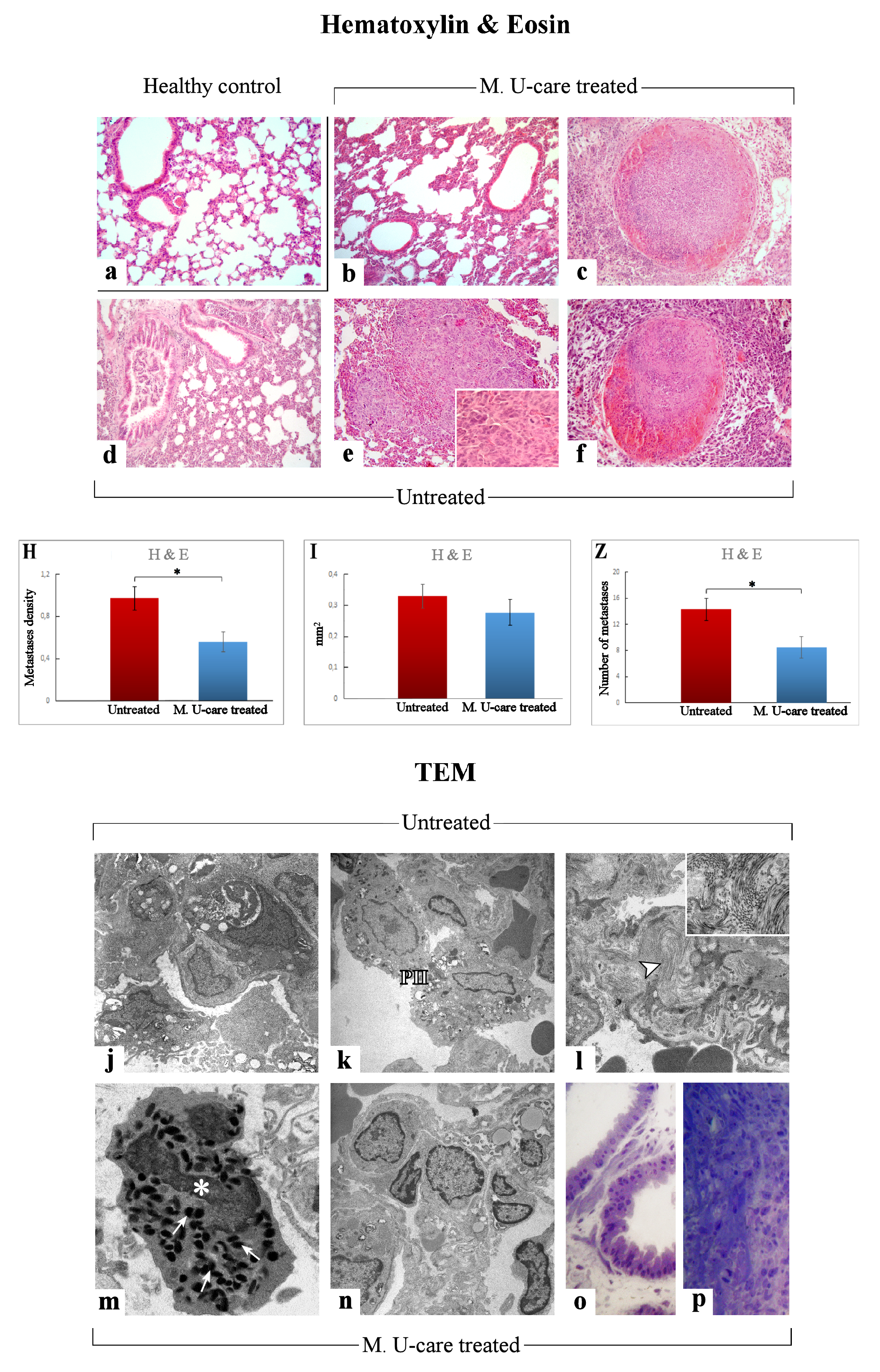 Ijms Free Full Text Novel Medicinal Mushroom Blend As A Promising Supplement In Integrative Oncology A Multi Tiered Study Using 4t1 Triple Negative Mouse Breast Cancer Model Html