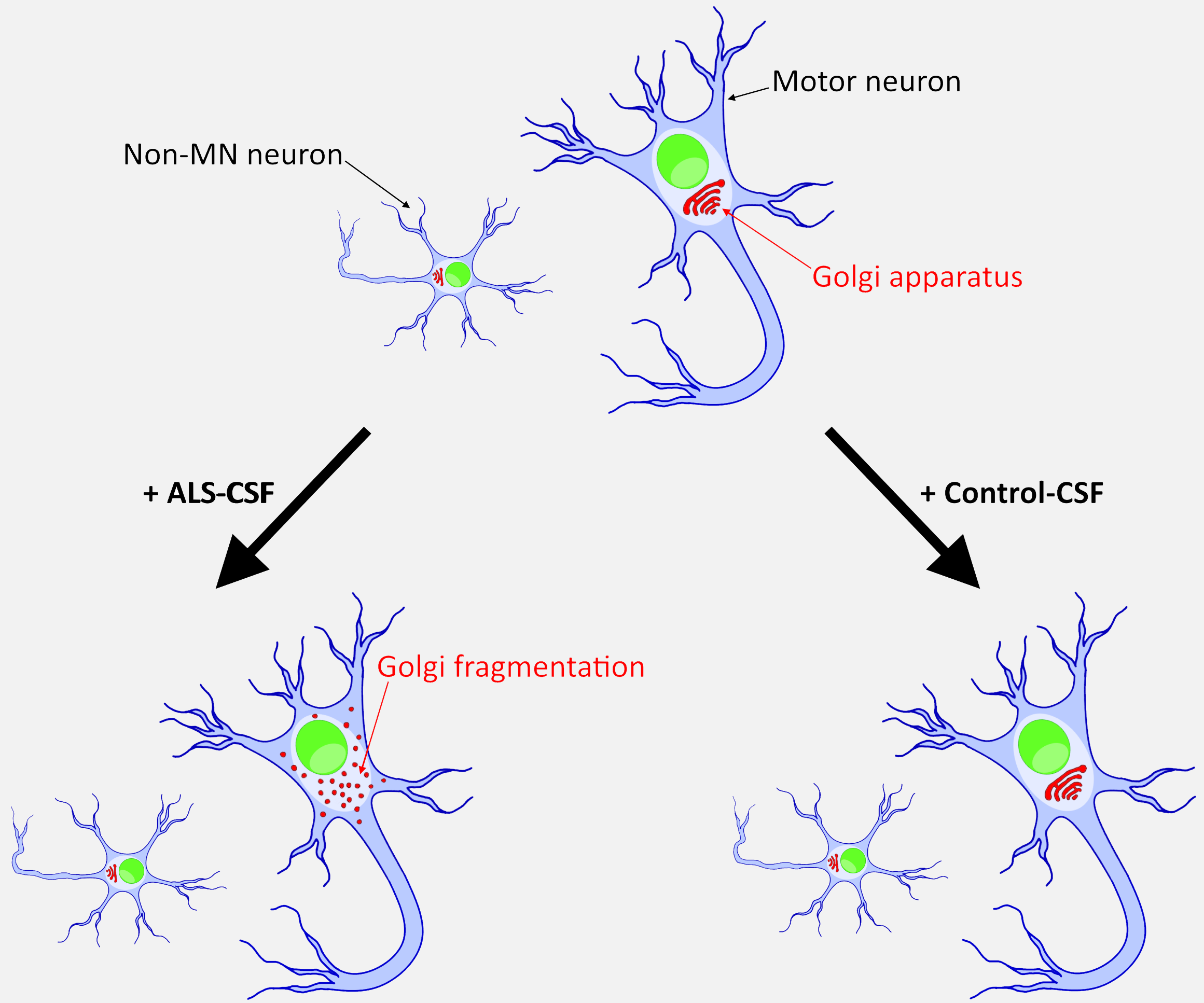 What Motor Neurons Are Affected By Als