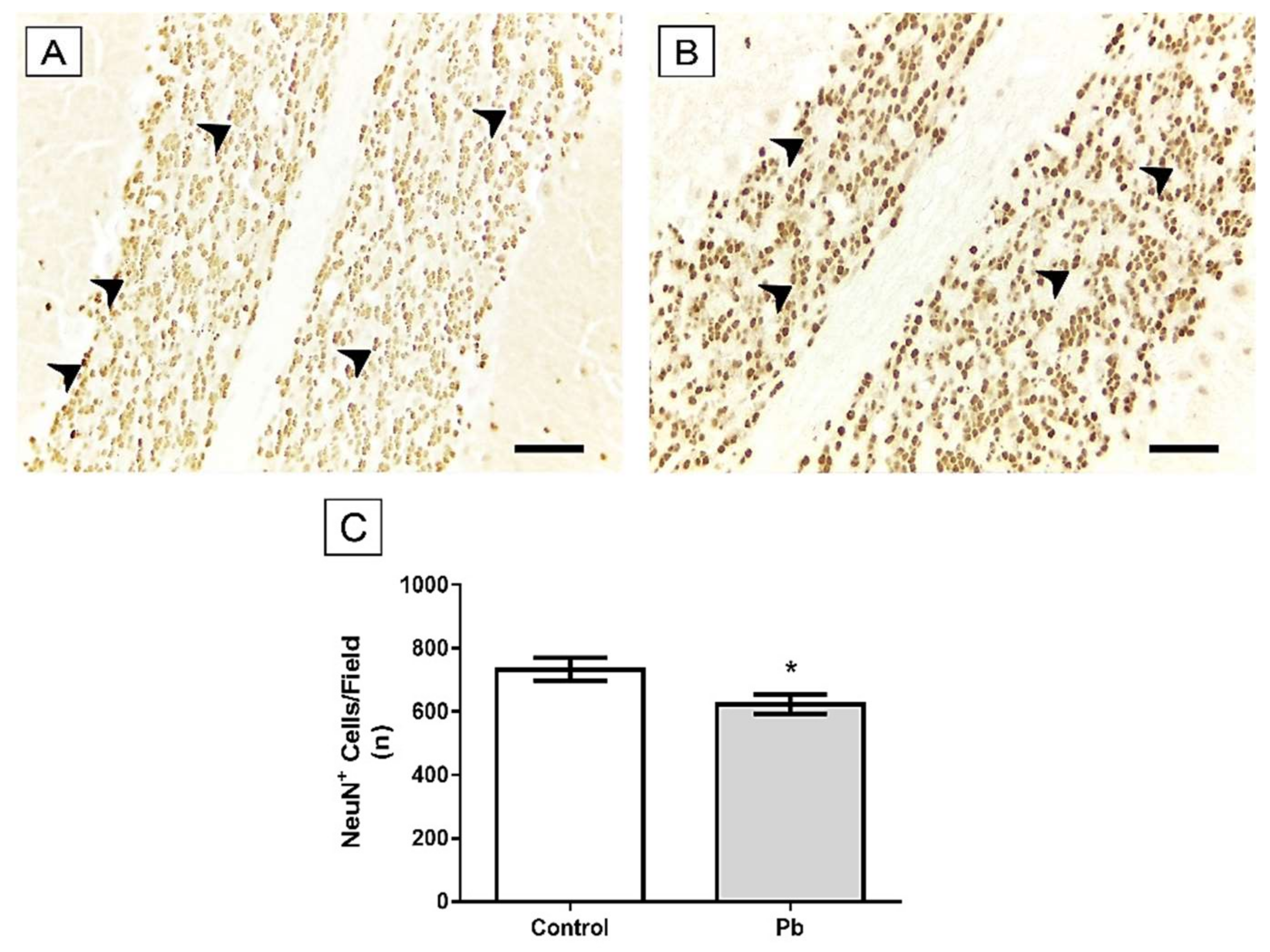 Ijms 21 03571 g005 Ijms 21 03571 g005