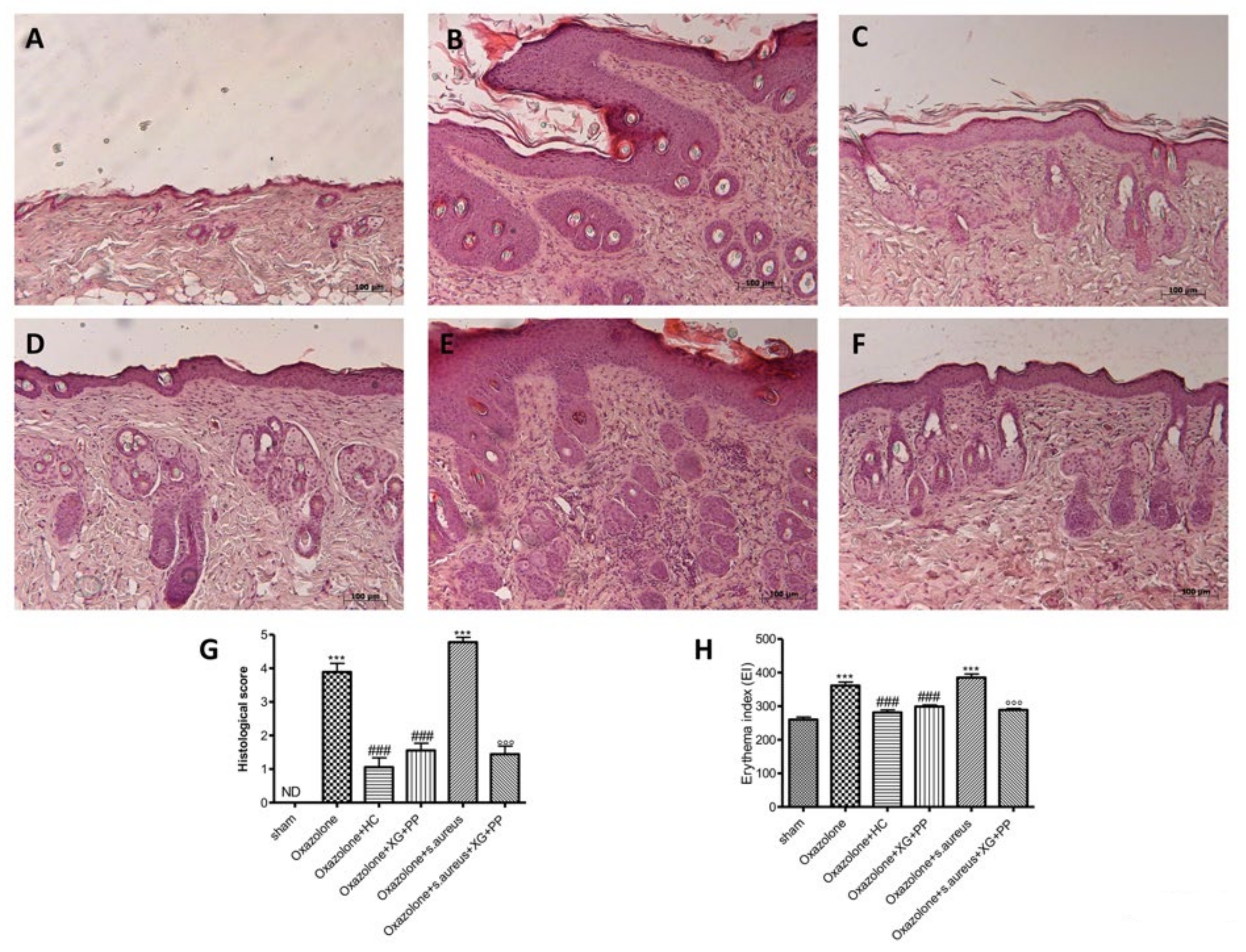 Ijms Free Full Text Effect Of A Product Containing Xyloglucan And Pea Protein On A Murine Model Of Atopic Dermatitis Html