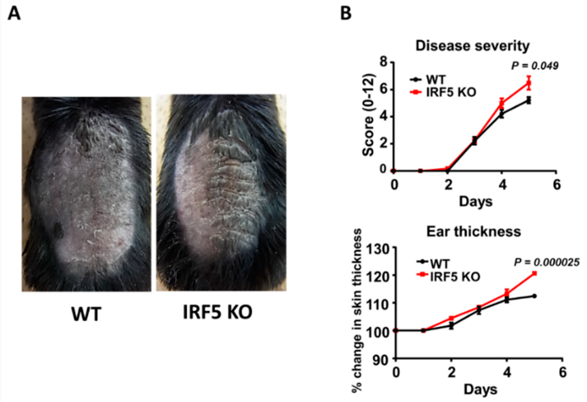 Ijms Free Full Text Exacerbated Imiquimod Induced Psoriasis Like Skin Inflammation In Irf5 Deficient Mice Html Ijms Free Full Text Exacerbated Imiquimod Induced Psoriasis Like Skin Inflammation In Irf5 Deficient Mice Html