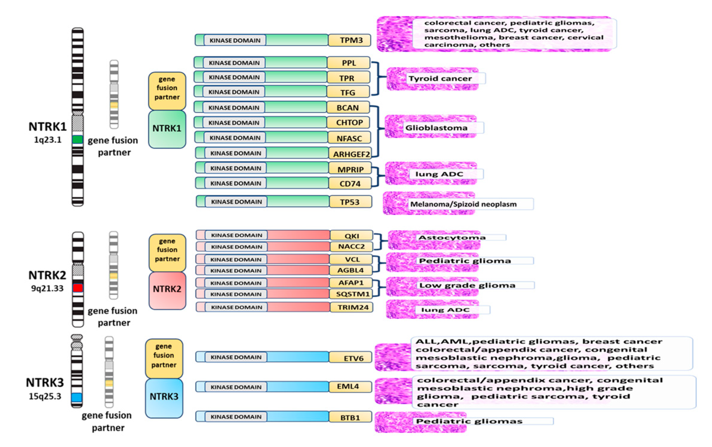 Ijms Free Full Text Ntrk Fusions From The Diagnostic Algorithm To Innovative Treatment In The Era Of Precision Medicine Html