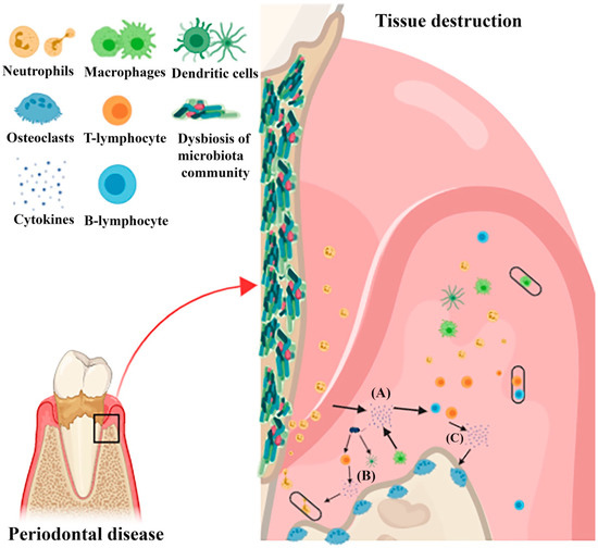 Ijms Free Full Text An Evidence Based Update On The Molecular Mechanisms Underlying Periodontal Diseases Html Ijms Free Full Text An Evidence Based Update On The Molecular Mechanisms Underlying Periodontal Diseases Html