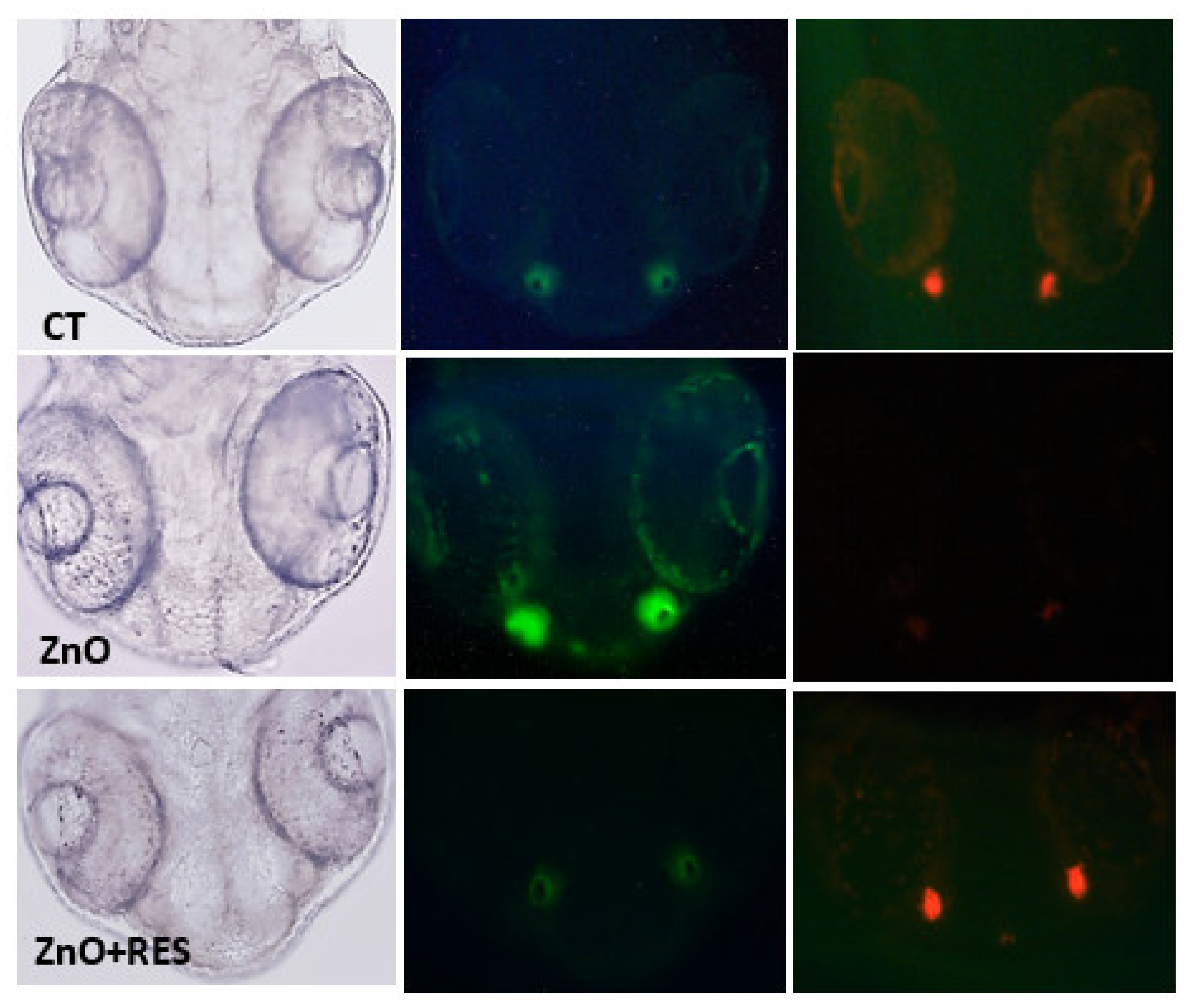 Ijms 21 03838 g005 Ijms 21 03838 g005