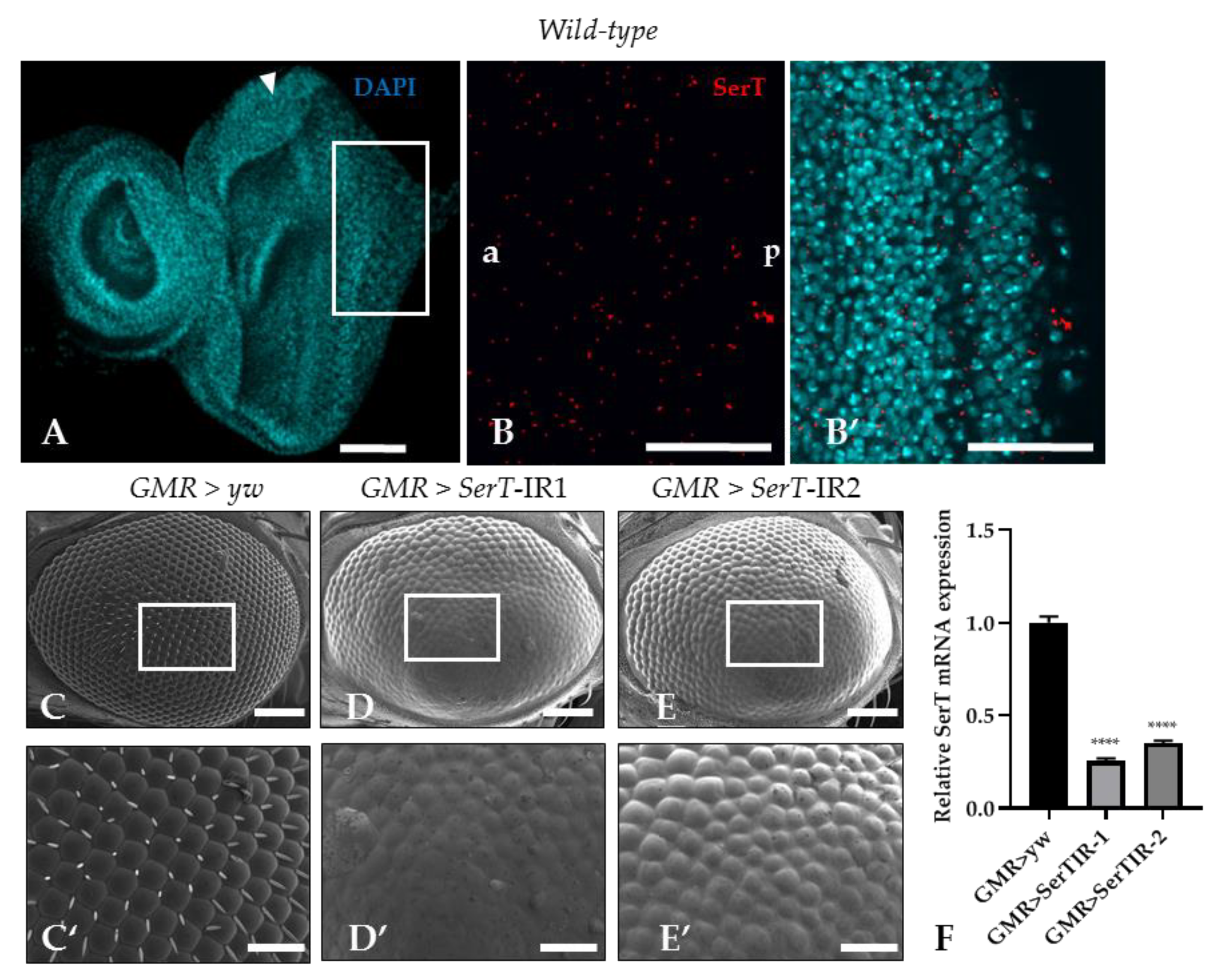 Ijms Free Full Text Role Of Serotonin Transporter In Eye Development Of Drosophila Melanogaster Html