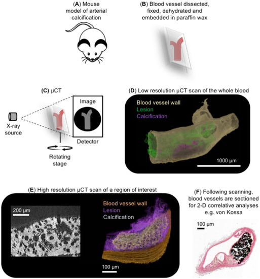 X-ray Micro-Computed Tomography: An Emerging Technology to