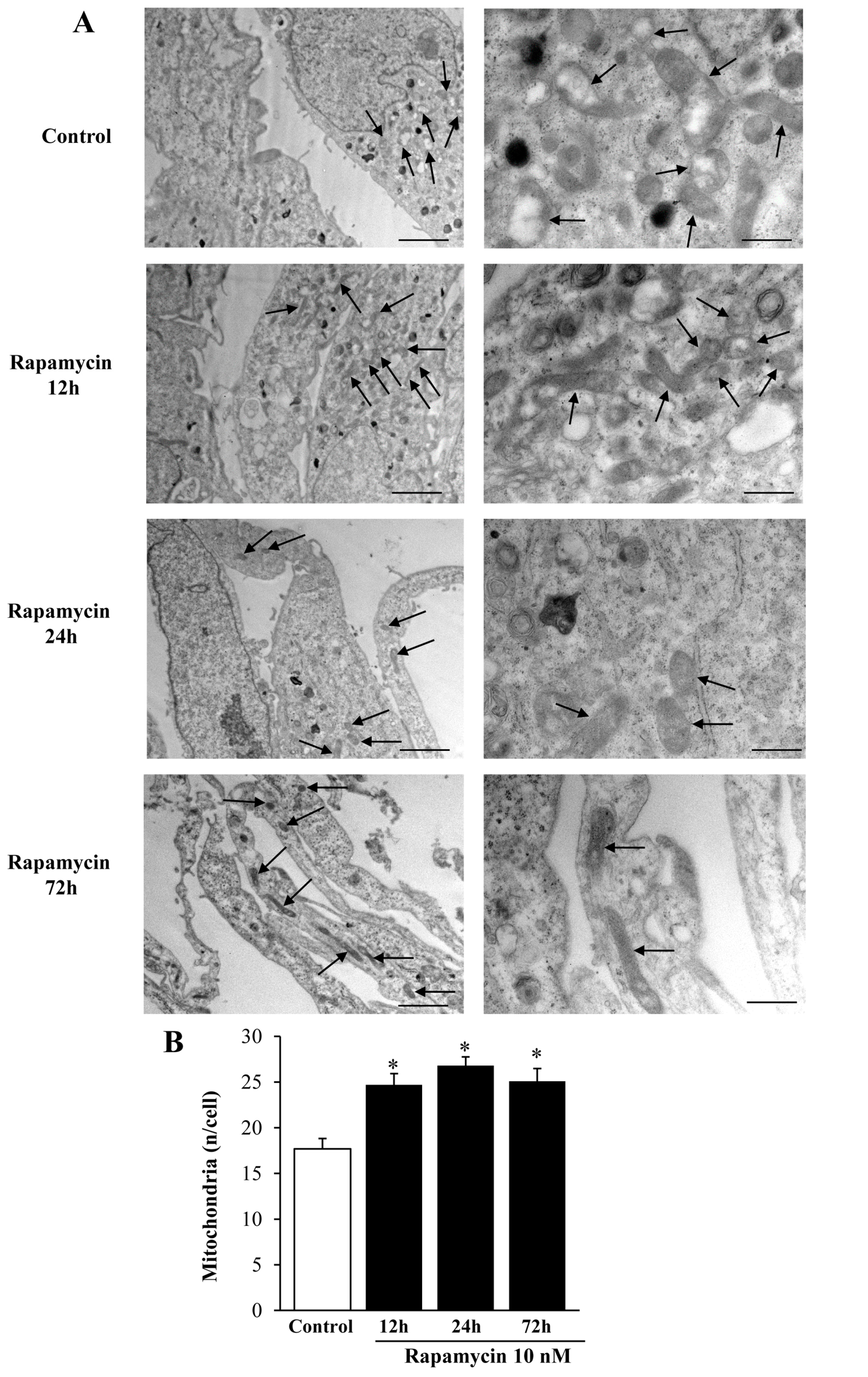 Ijms 21 04570 g004 Ijms 21 04570 g004