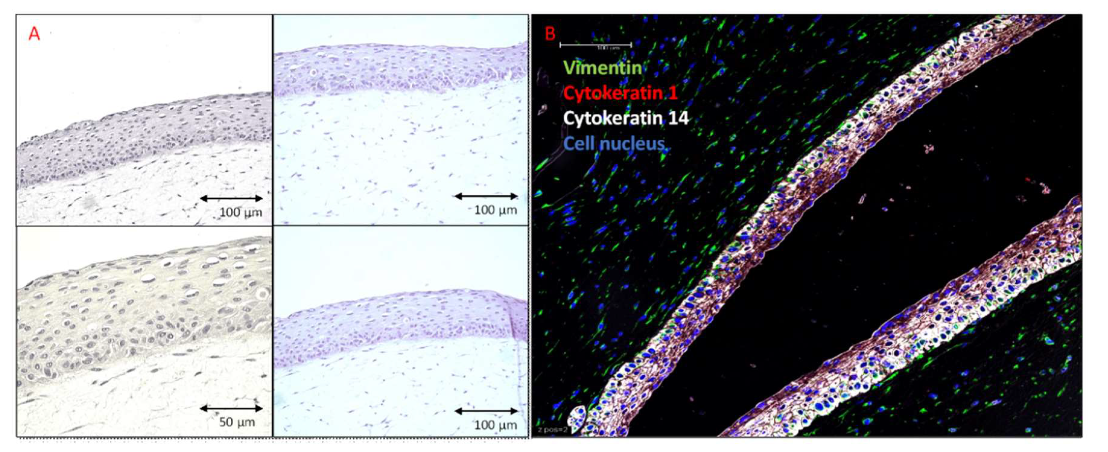 Human skin reconstitution in the cell-sorted skin equivalent (CeSSE)