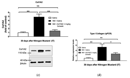 The HSP90 Inhibitor, AUY-922, Ameliorates the Development of