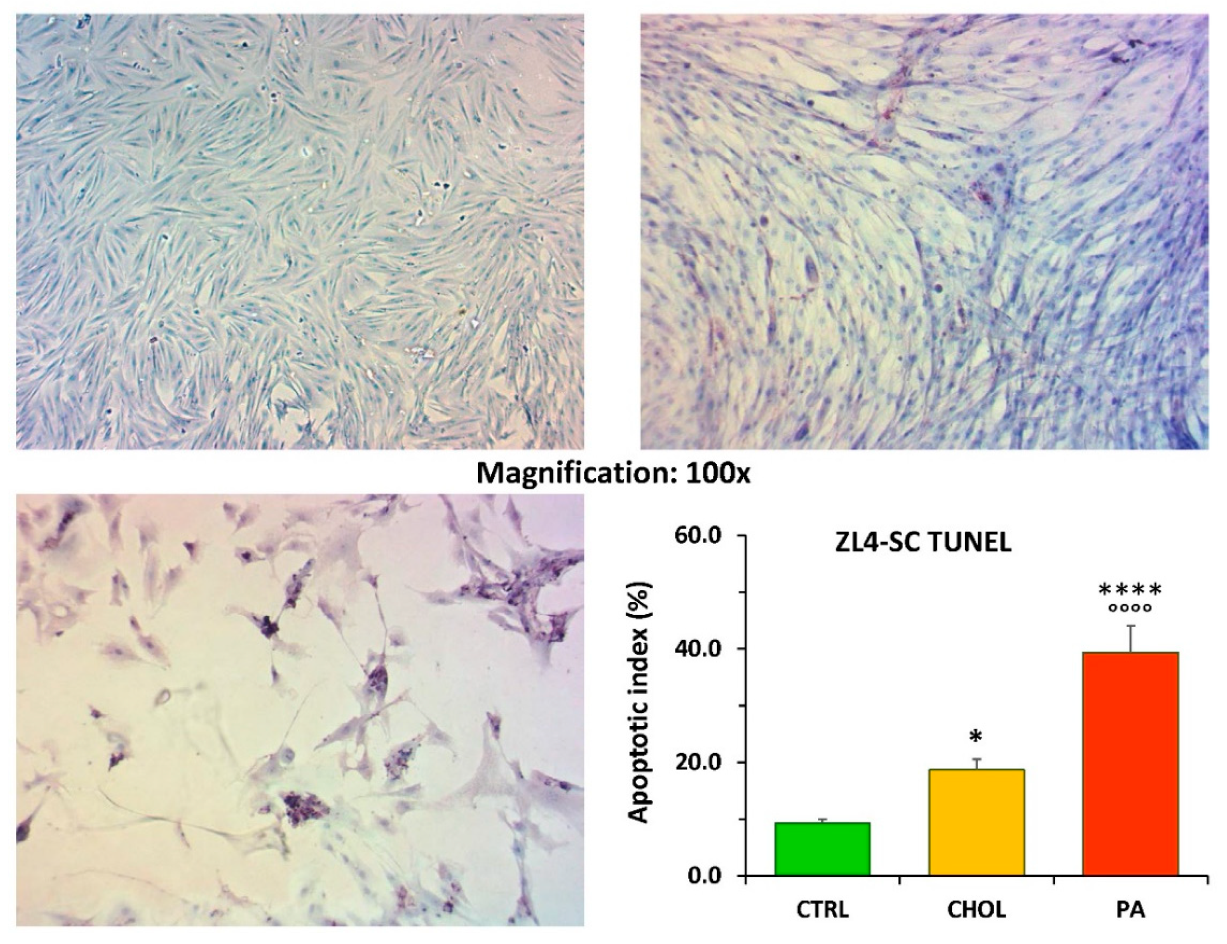 Ijms Free Full Text Evaluation Of The In Vitro Damage Caused By Lipid Factors On Stem Cells From A Female Rat Model Of Type 2 Diabetes Obesity And Stress Urinary Incontinence Html