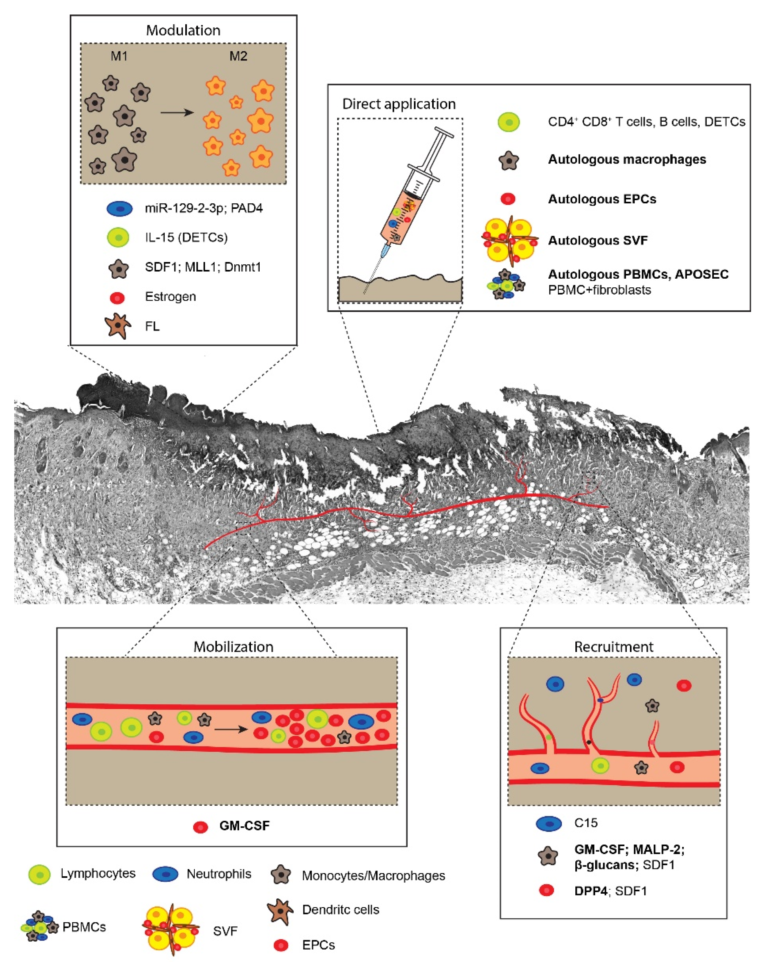 Ijms Free Full Text Immune Cell Therapies To Improve Regeneration And Revascularization Of Non Healing Wounds Html