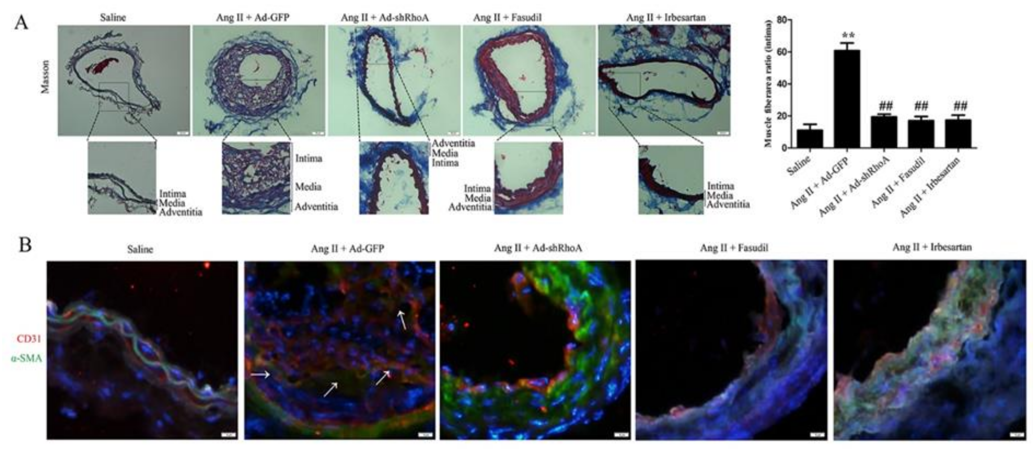 Ijms 21 05398 g009 Ijms 21 05398 g009