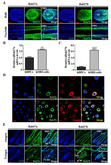 Inhibition of Rab27a and Rab27b Has Opposite Effects on the Regulation ...