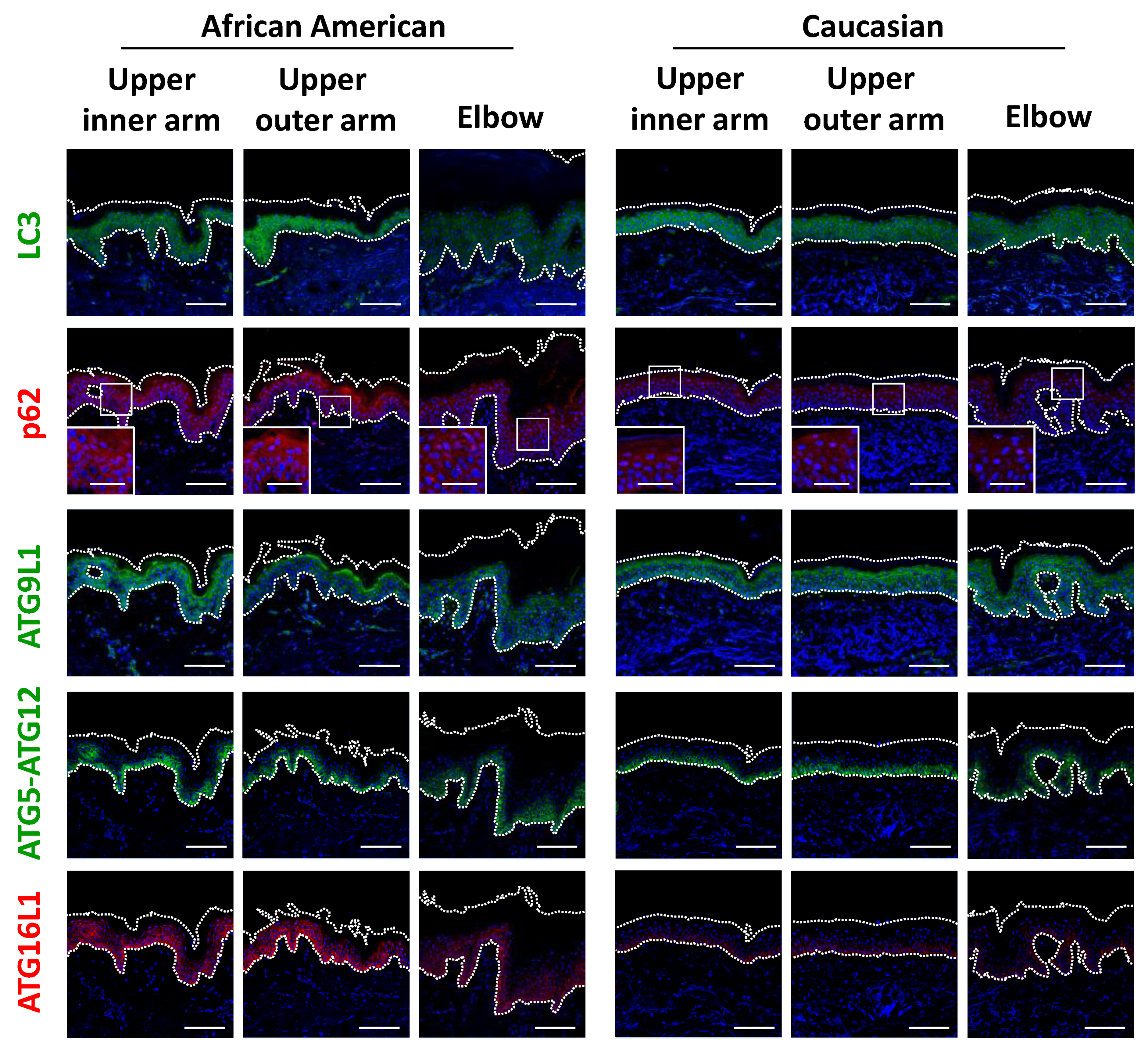 Ijms 21 05708 g005 Ijms 21 05708 g005