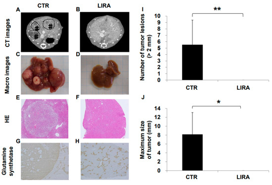 Glucagon-Like Peptide-1 Receptor Agonist Prevented the