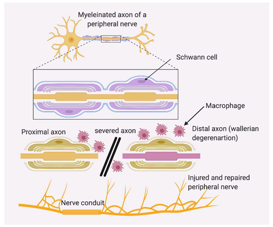 LLT Laser Therapy for Peripheral Neuropathy El Paso, TX(2019)