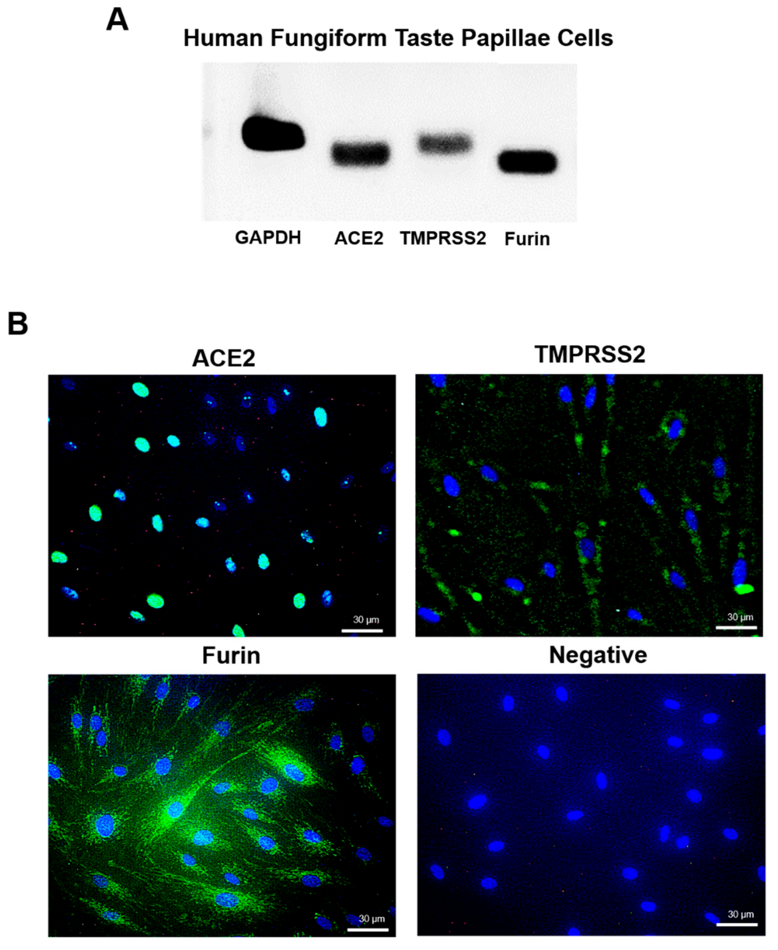 Ijms 21 06000 g006 Ijms 21 06000 g006