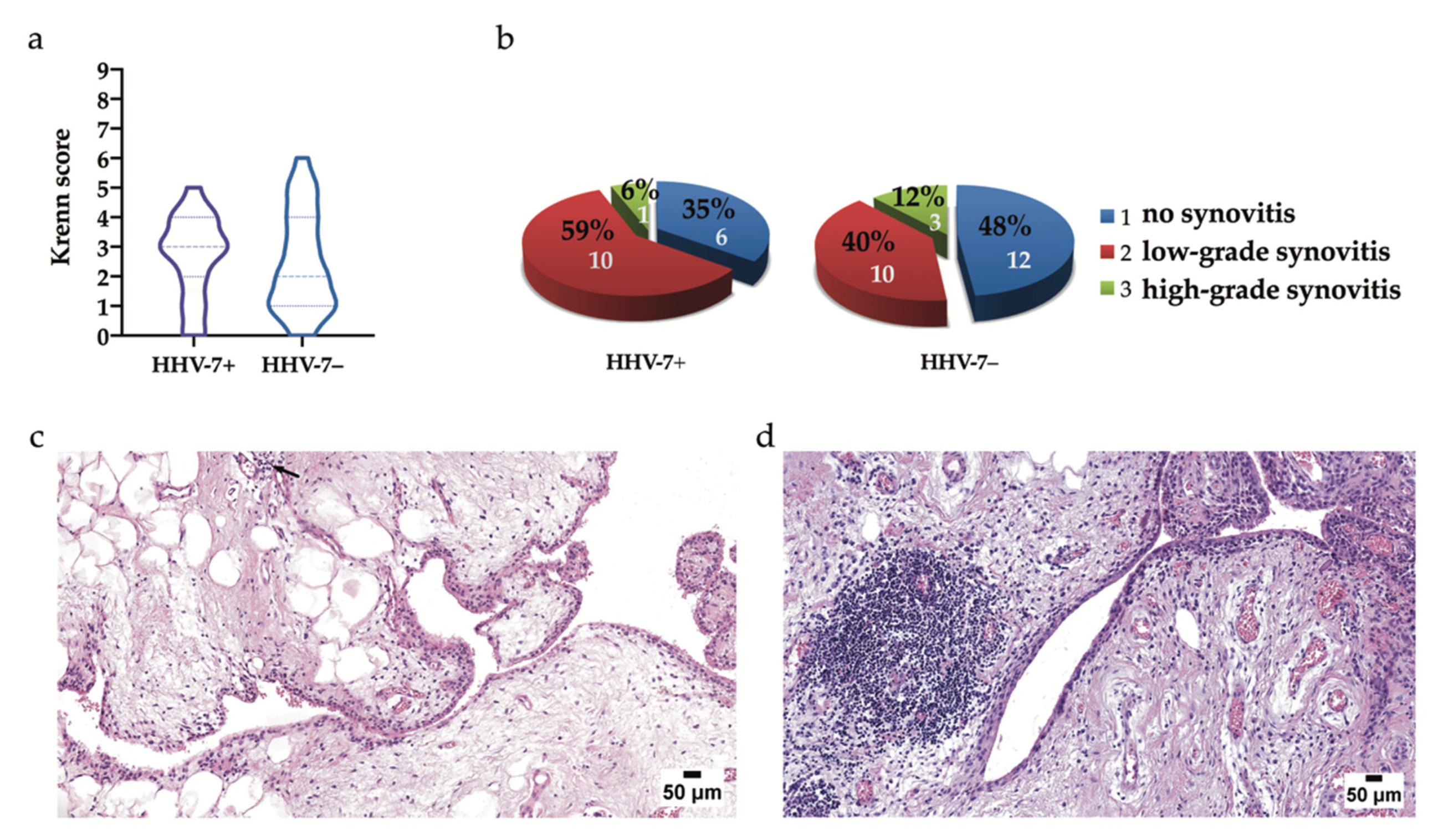 Ijms 21 06004 g003 Ijms 21 06004 g003