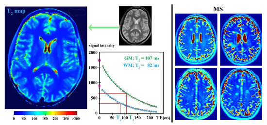 入荷通知 アプリ おすすめ Current Methods of Magnetic Resonance for Noninvasive 語学+参考書