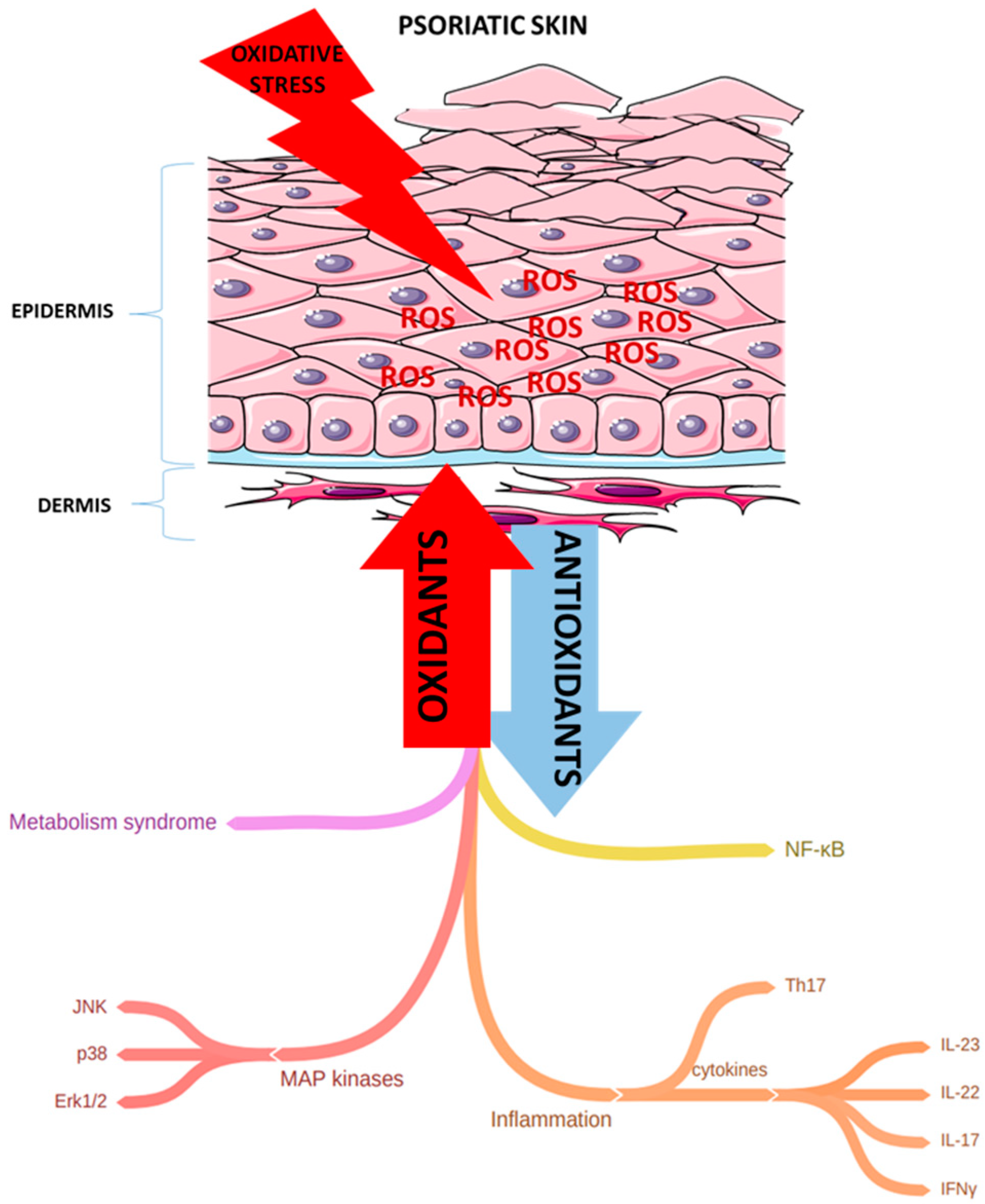 Psoriasis kezelés Diet Cure