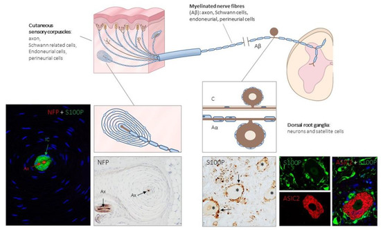 Ijms Free Full Text Peripheral Mechanobiology Of Touch Studies On Vertebrate Cutaneous Sensory Corpuscles Html Ijms Free Full Text Peripheral Mechanobiology Of Touch Studies On Vertebrate Cutaneous Sensory Corpuscles Html