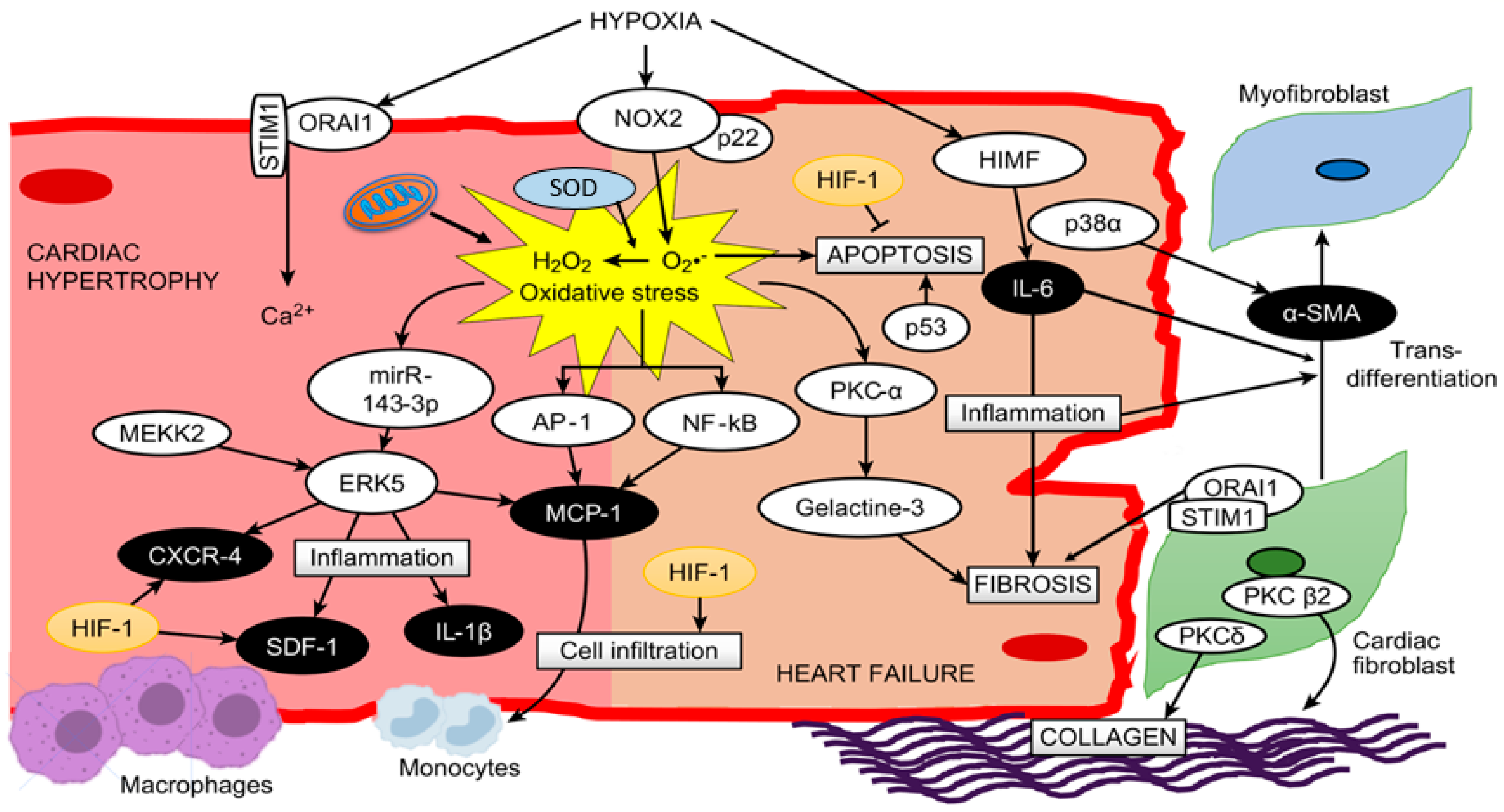 Hypertrophy Heart Failure