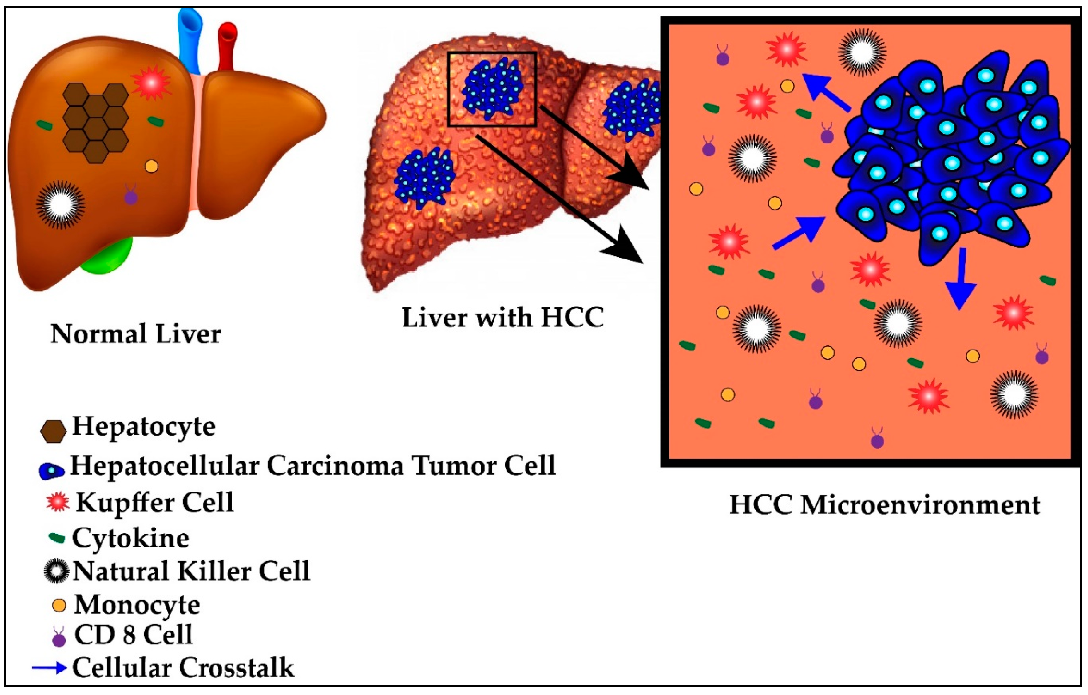 what is primary peritoneal cancer prognosis